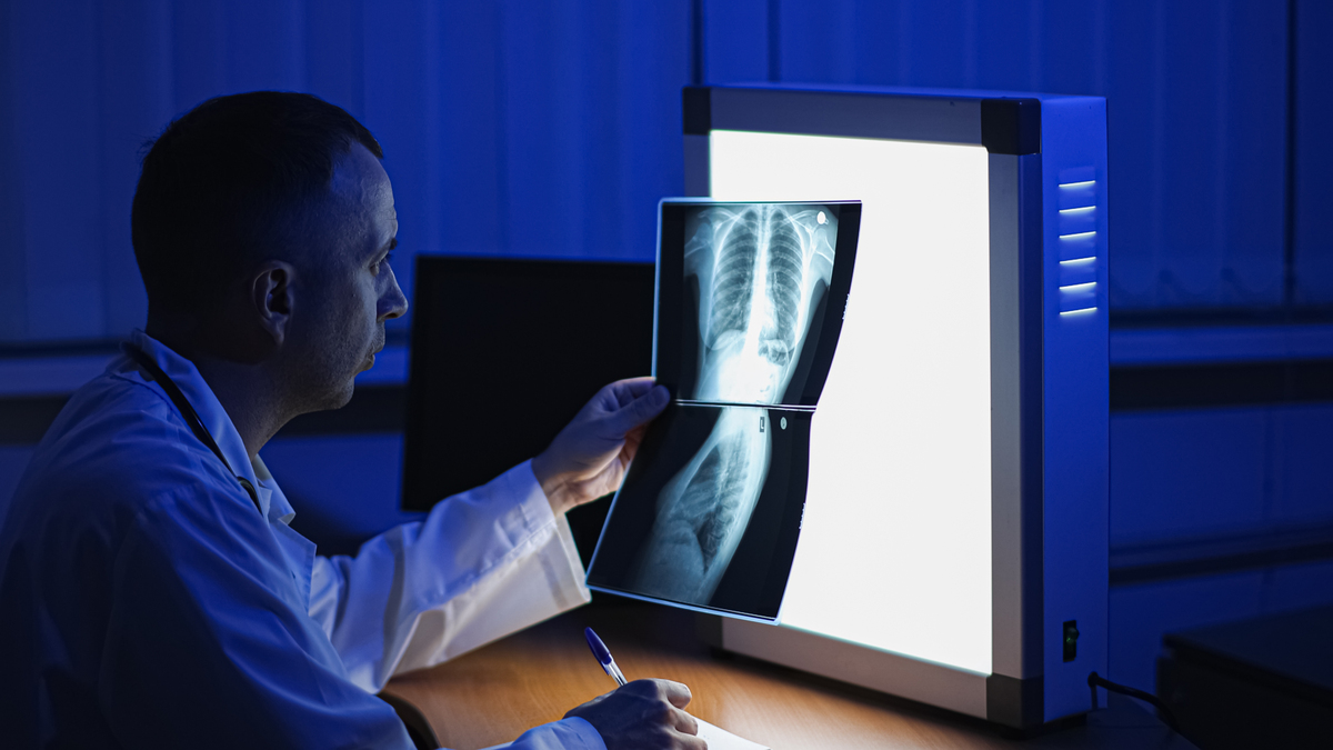 医学影像技术的未来前景：应用范围广阔，挑战与机遇并存