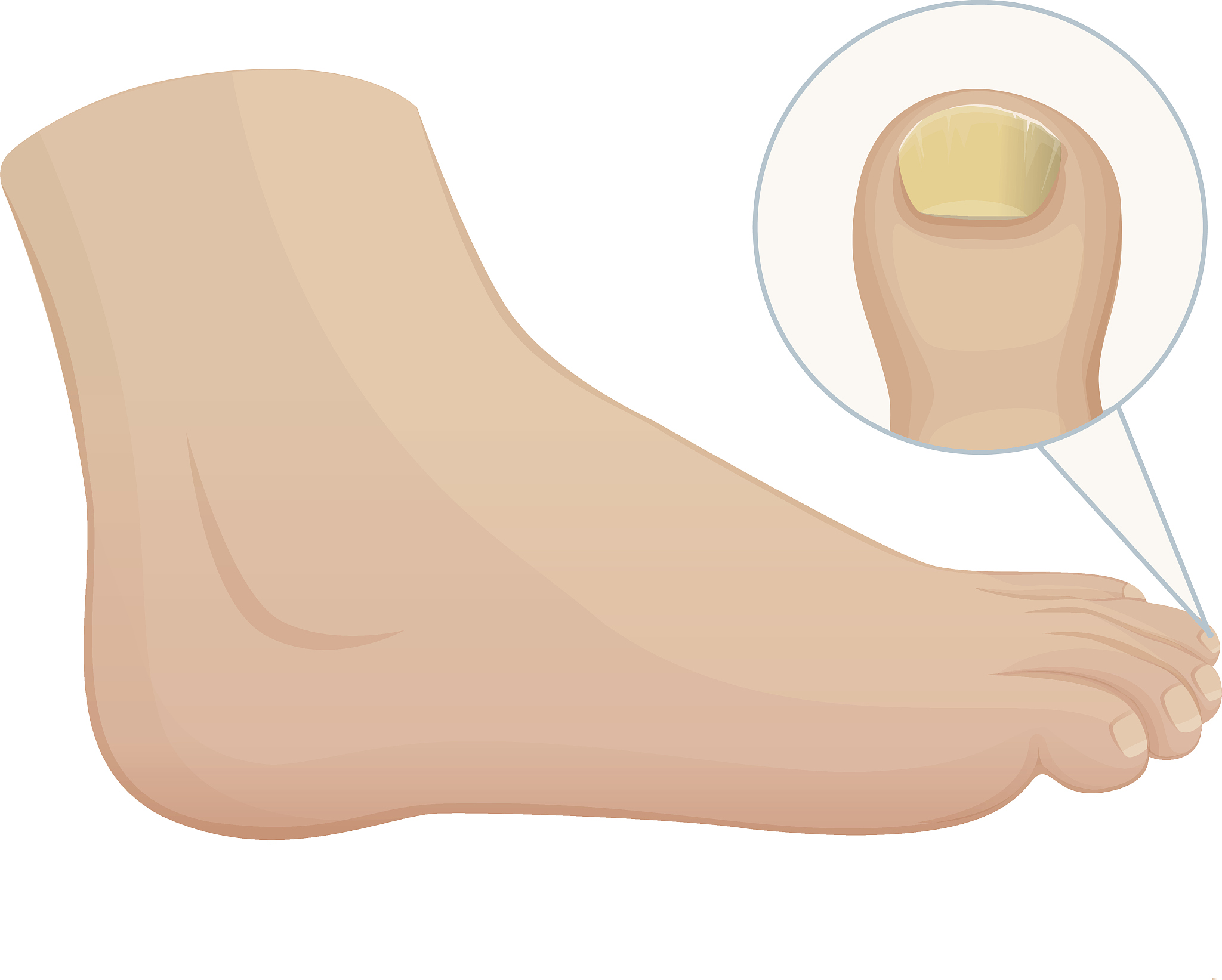 foot front with fundus on the finger