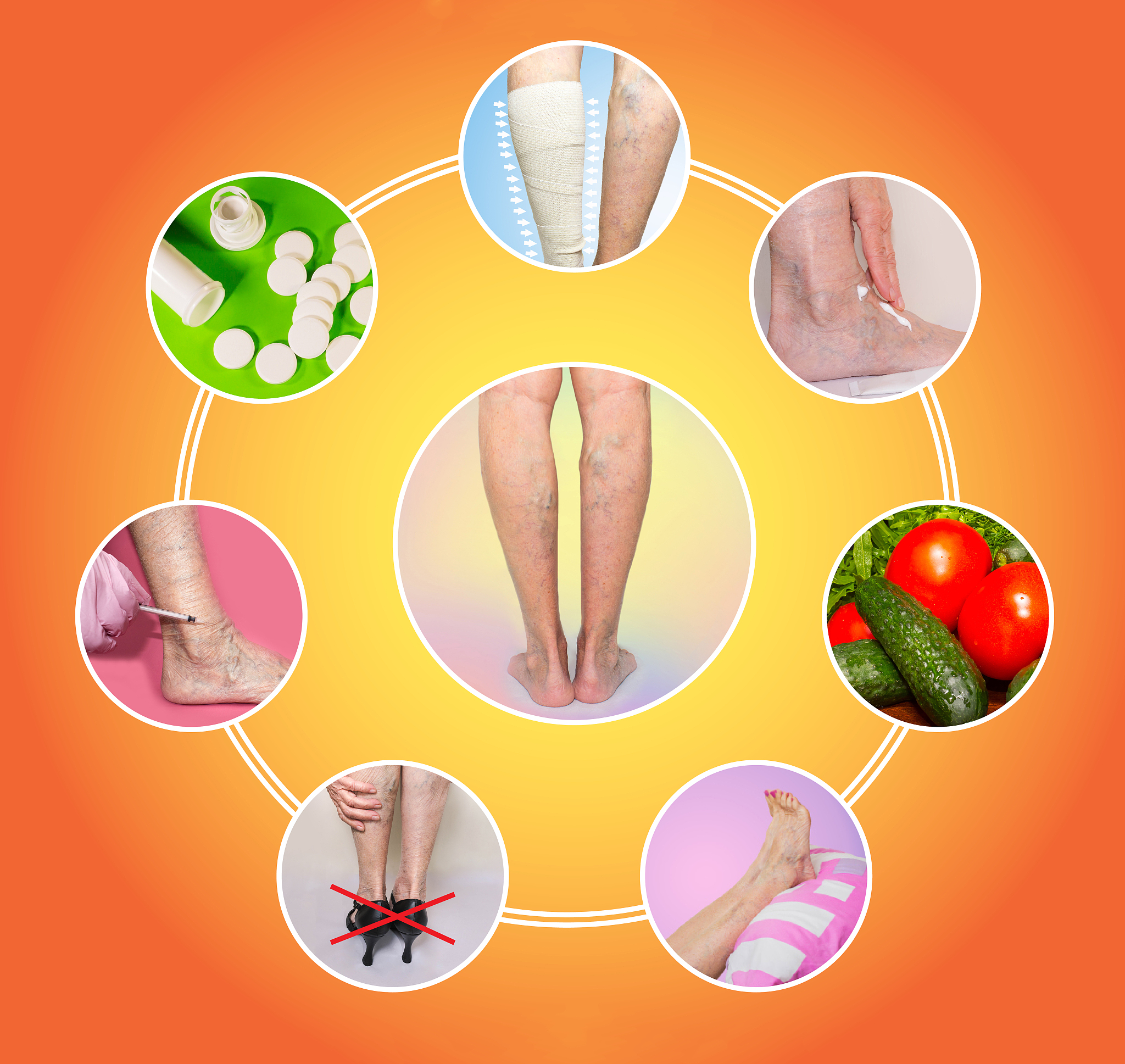 写一个静脉曲张病宣教论文的实践心得简短150字以内