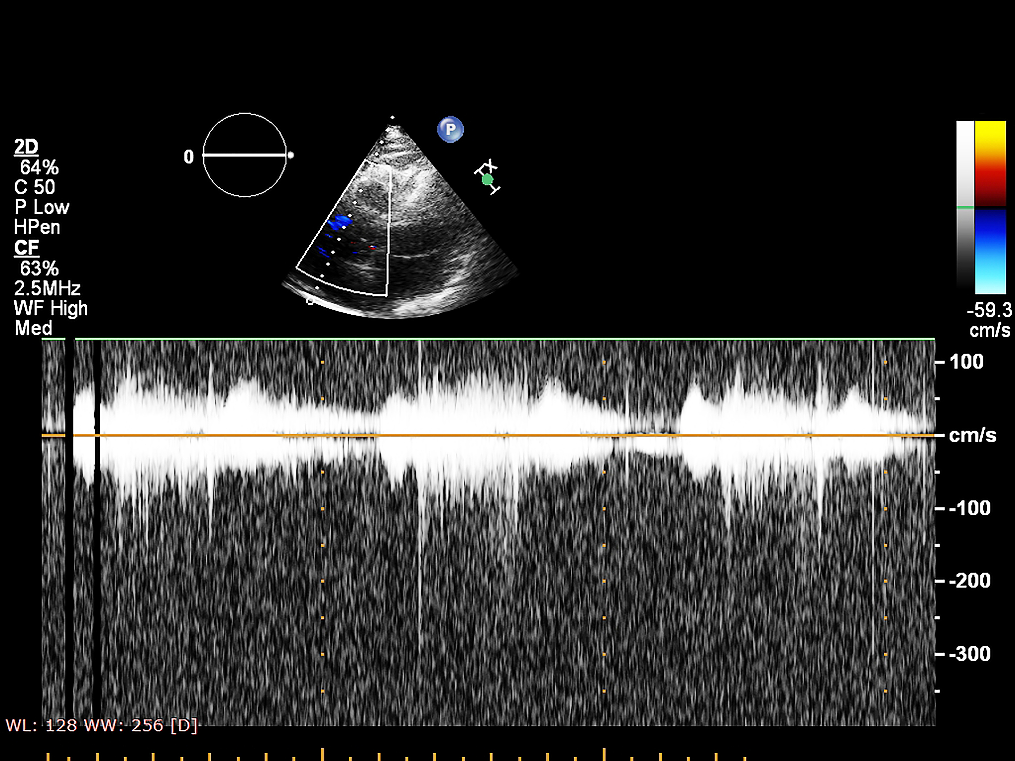超声检测技术：工程构件损伤检测的利器