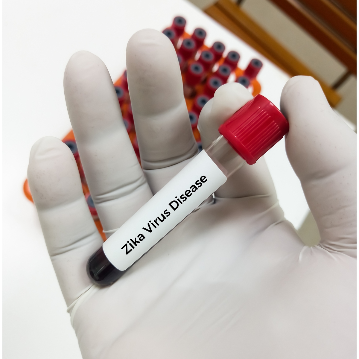 为了评估EV-G-PLP病毒的传播能力利用口服途径攻毒3日龄ICR乳鼠在攻毒后3天通过RT-PCR进行病毒回收和病毒检测结果显示ICR乳鼠脑组织及其他组织器官均显示出特定的条带表明EV-G-PLP毒株可以感染乳鼠脏器。检查语病并优化