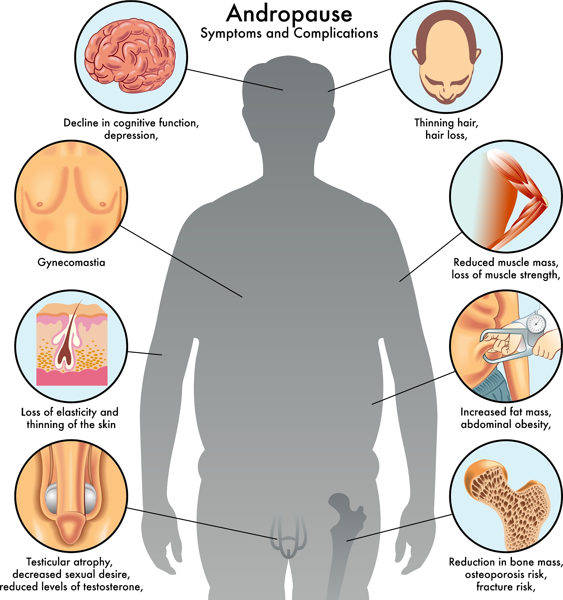 胰岛细胞瘤：导致继发性肥胖的原因