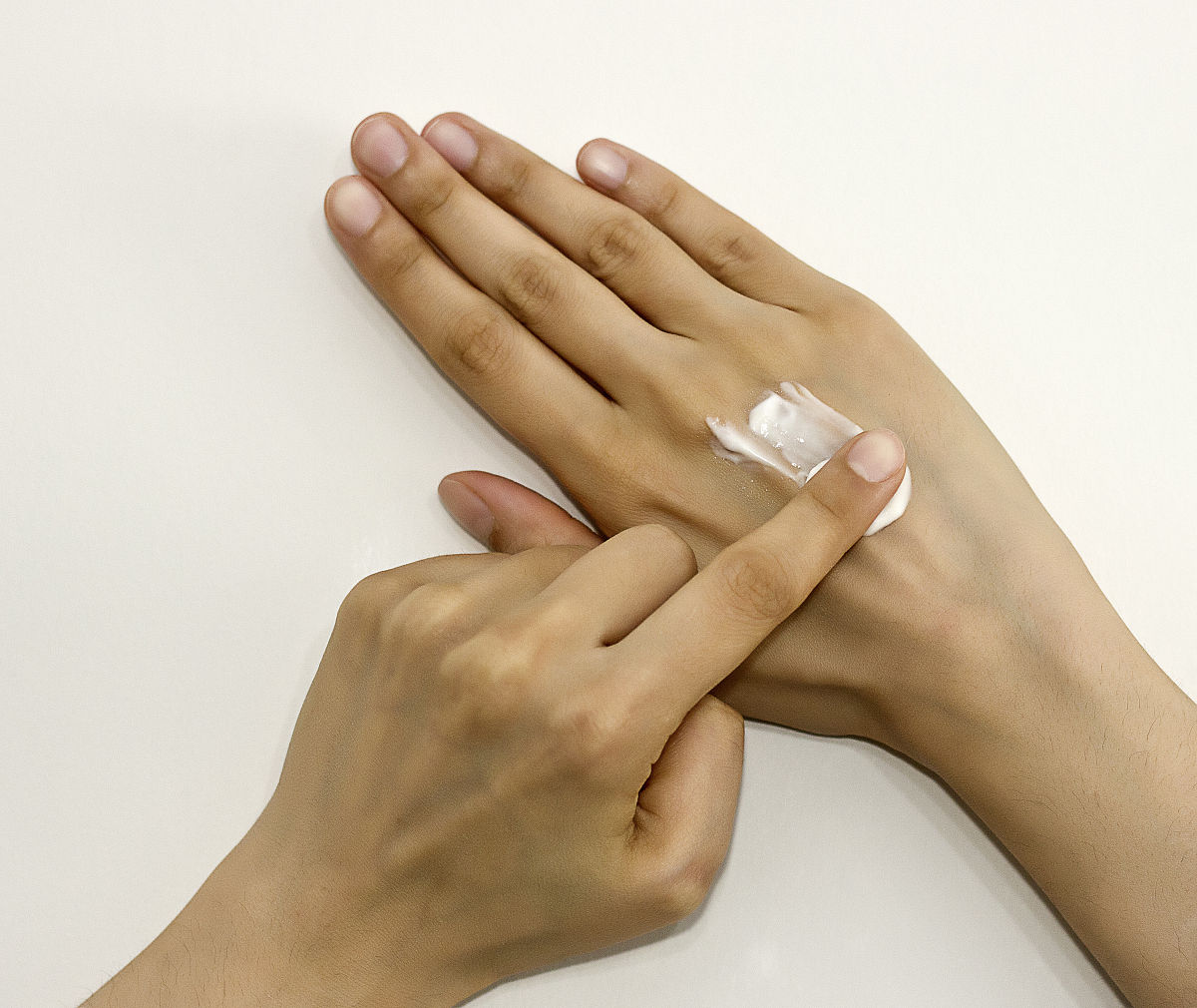 手汗手汗是一种常见的现象它指的是手掌或手指多汗或出汗过多。手汗可能与多种因素有关例如体温升高、情绪波动、神经疾病、荷尔蒙水平失调和药物副作用等。对于手汗的治疗首先需要找到原因消除引起手汗的基础疾病。同时可以尝试以下方法：1 直接控制汗液分泌：可以使用止汗剂、干爽粉等外用药物进行控制。2 手部保健：保持手部清洁频繁洗手穿透气性好的手套等。3 生活习惯：调整自己的饮食增加运动量避免吸烟和饮酒等。4 医