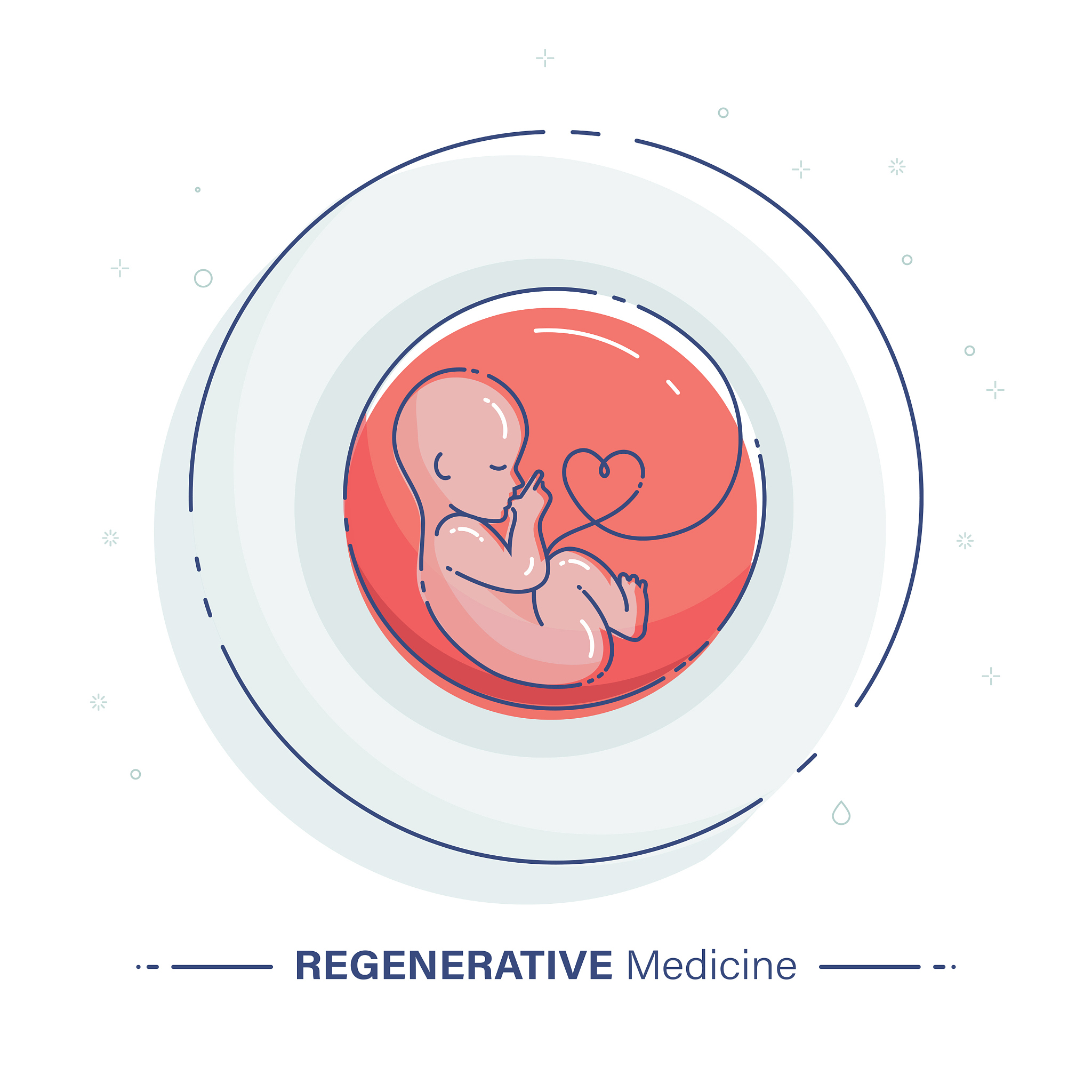 脐带间充质干细胞调控CXCR4和TGF-β治疗宫腔粘连：中西医结合研究