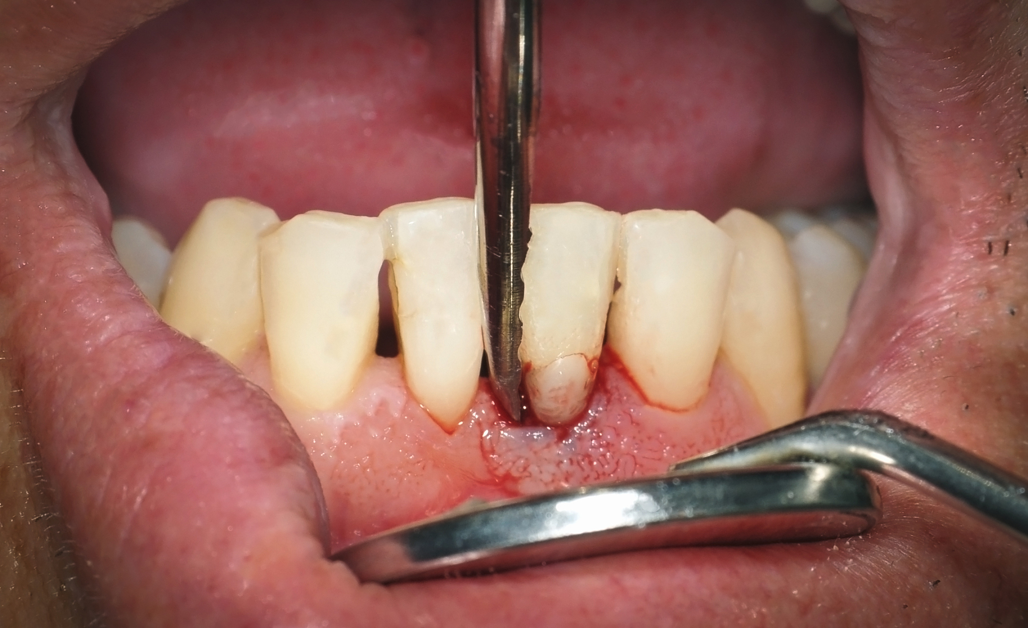 四川卫生学校口腔专业招生用发