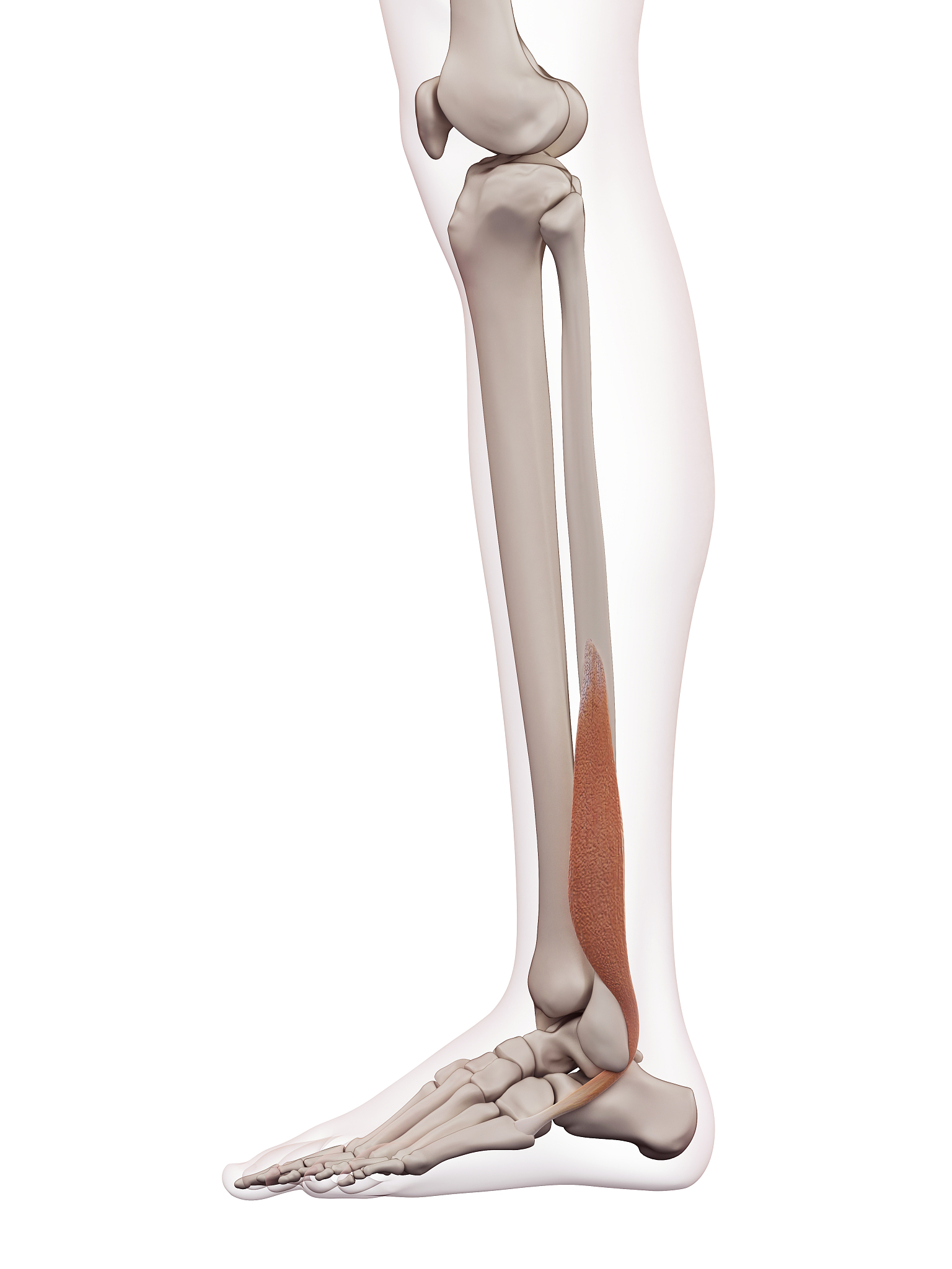 上臂矫正根：手术和康复治疗的支撑物