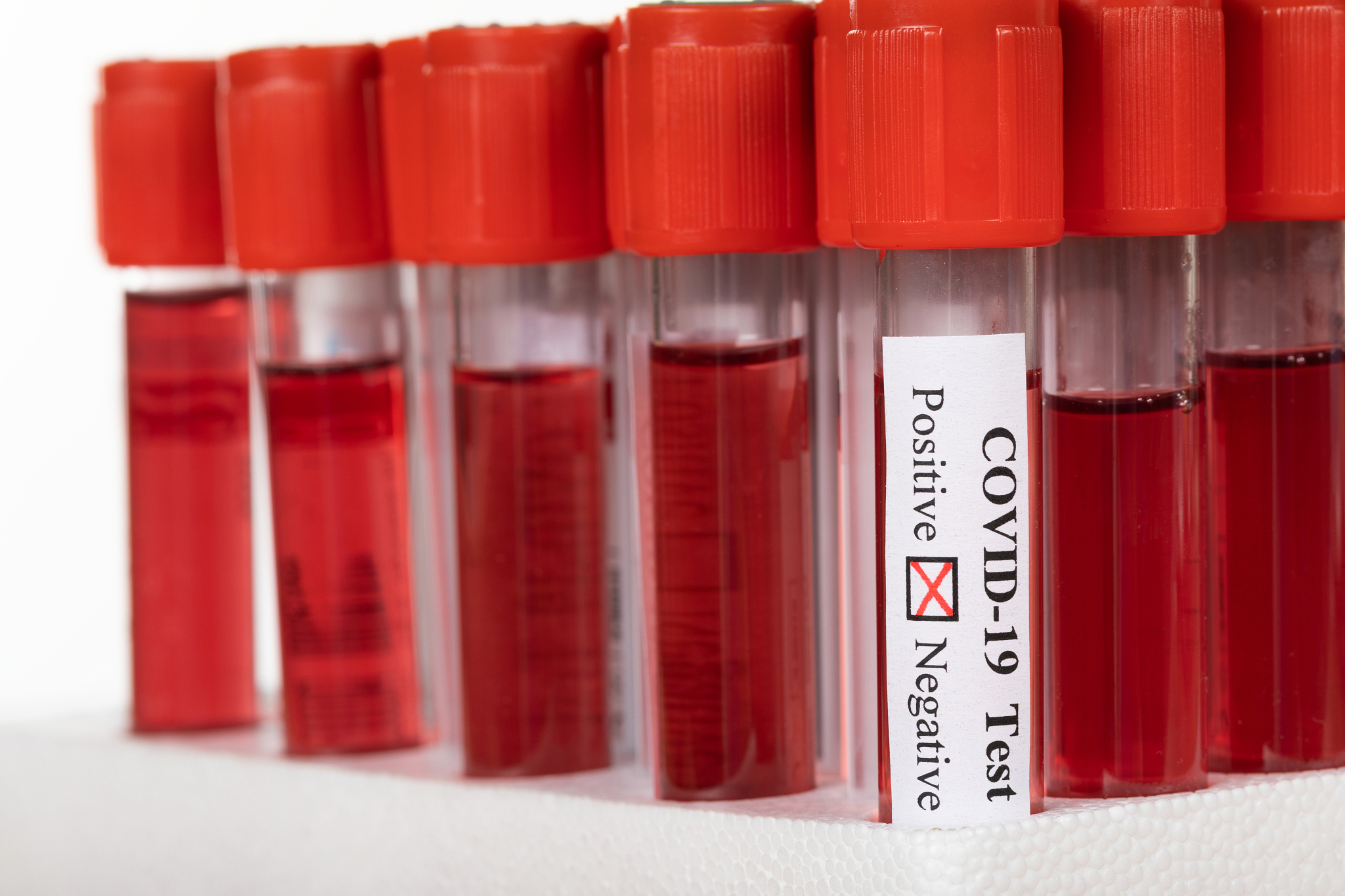 如何用湿润的红色石蕊试纸检测 NH4+ 离子