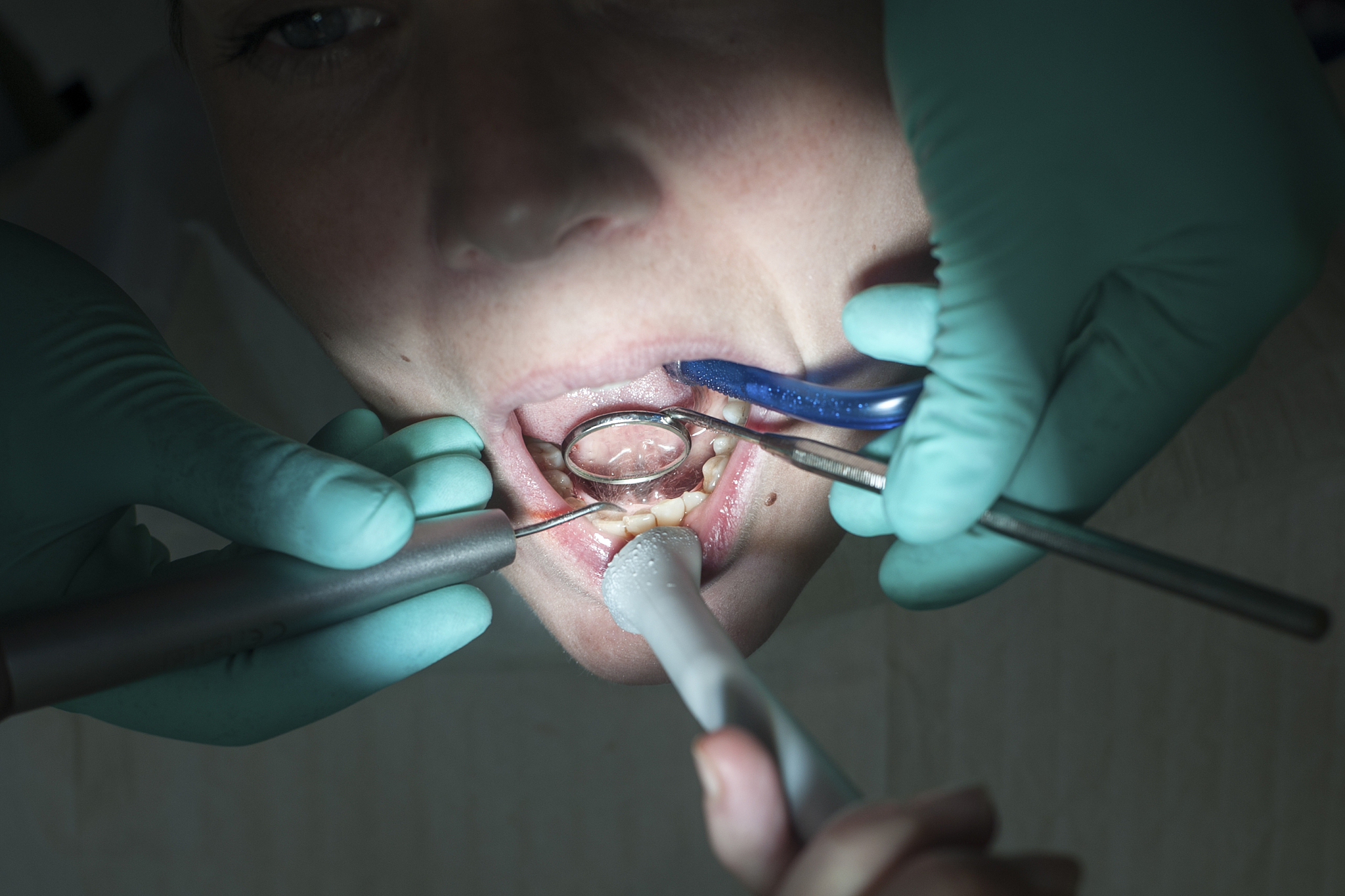 close-up of dentist treatment to patient