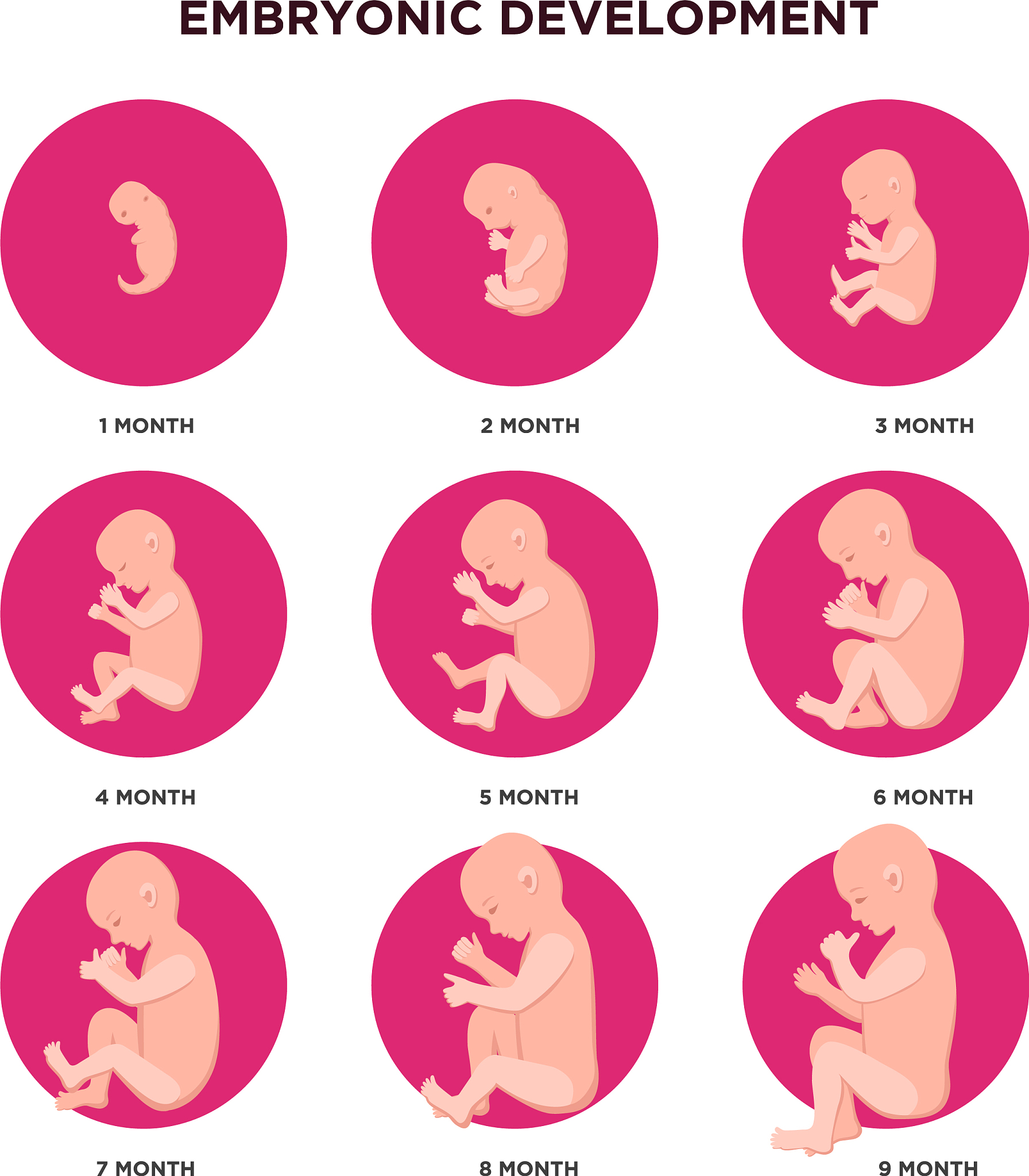 早产预防与治疗：保障母婴健康的重要课题