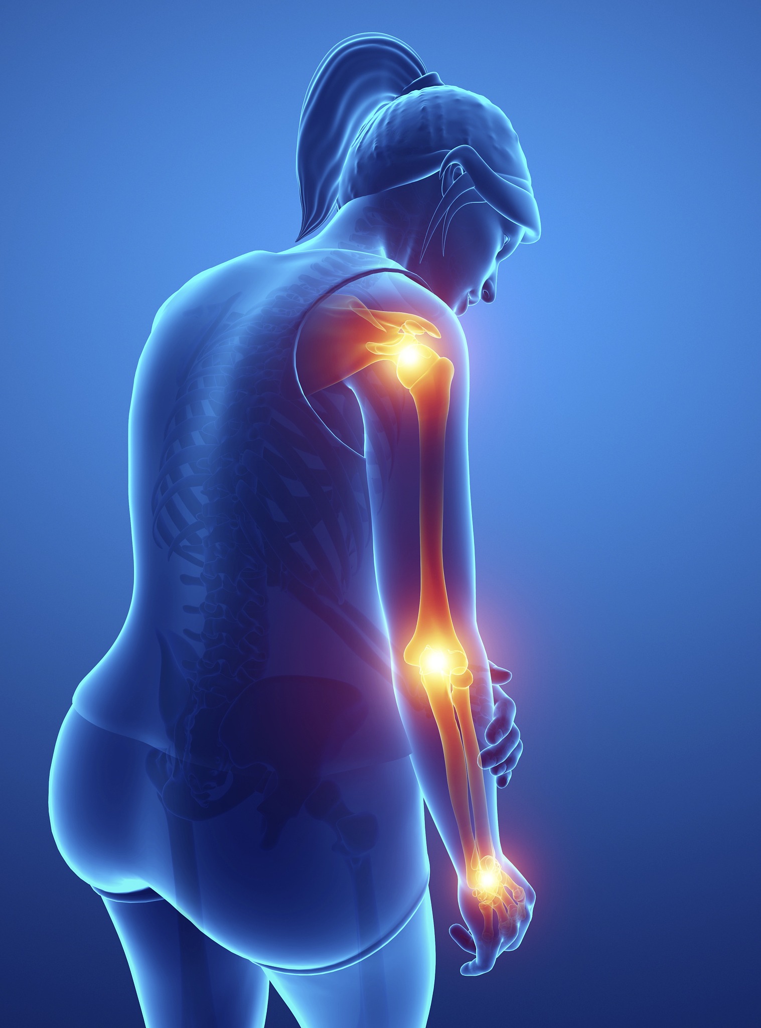 woman with arm pain, illustration