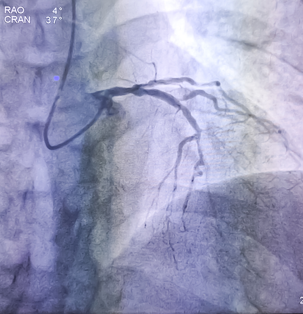 造影剂的必要条件：安全、有效、可靠