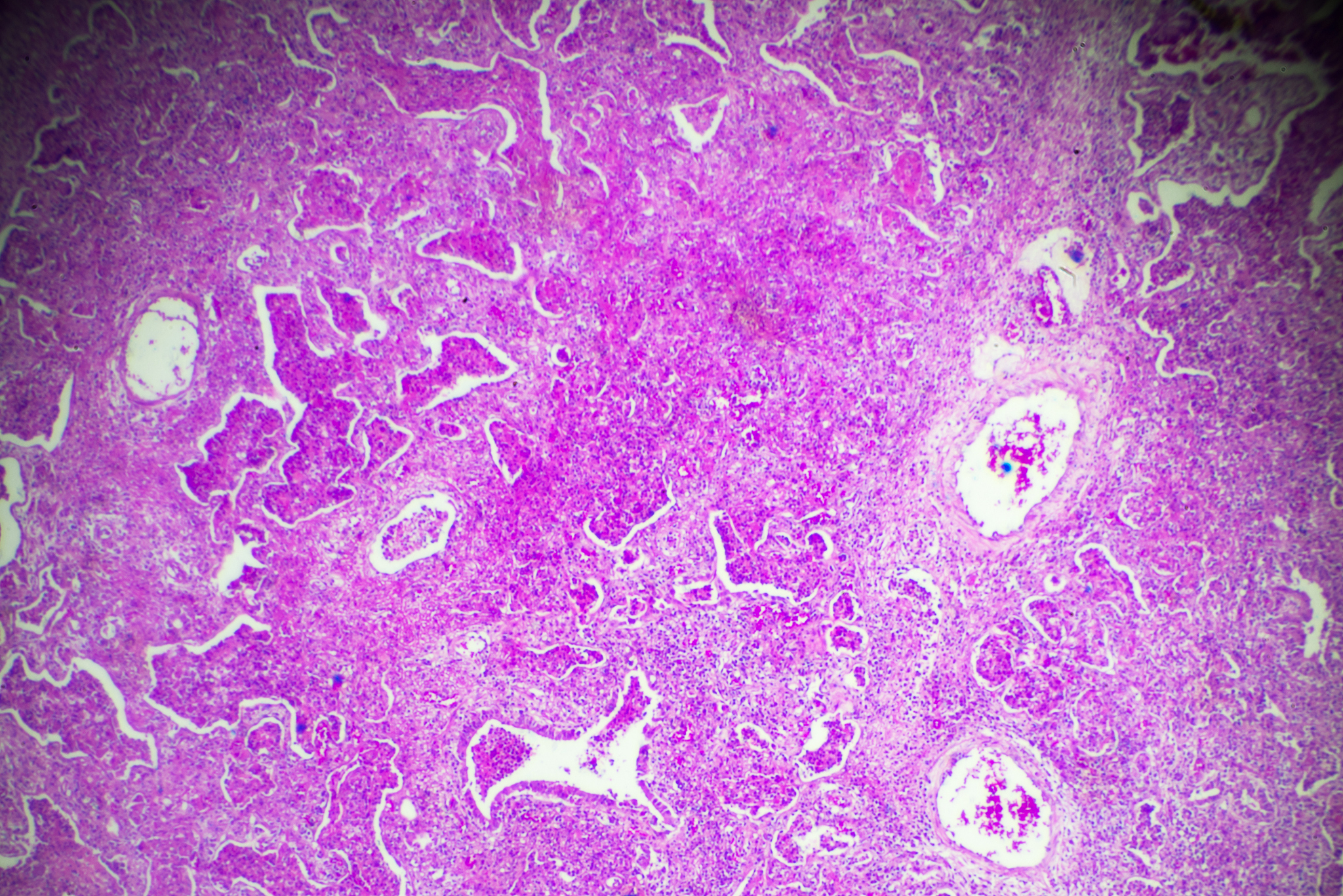 请帮我详细说明以下这篇文献并仔细解释其实验方法Caspase-411–MediatedPulmonaryArteryEndothelialCellPyroptosisContributestoPulmonaryArterialHypertension