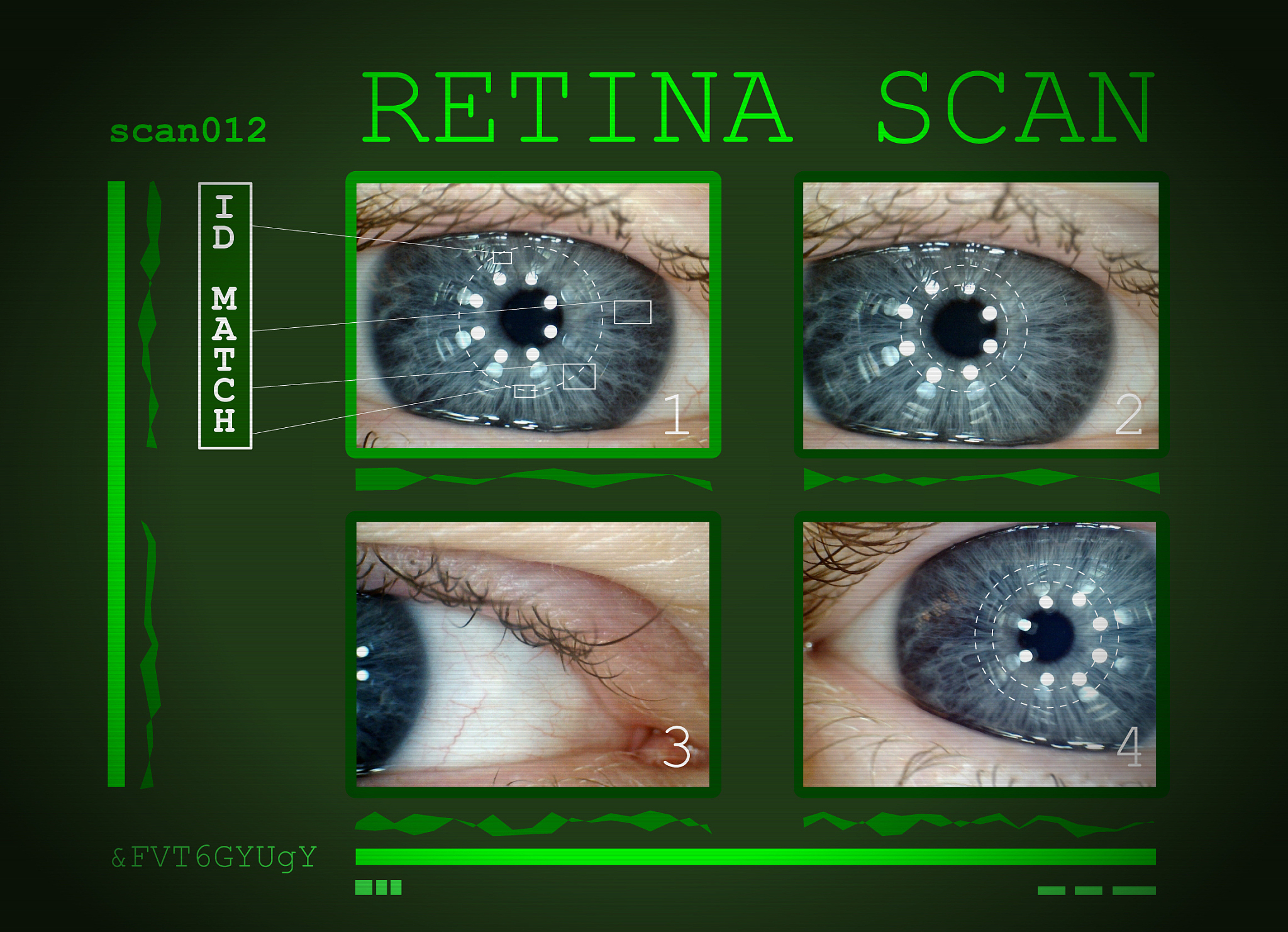 犬渐进性视网膜萎缩变性-RCD1型治疗措施