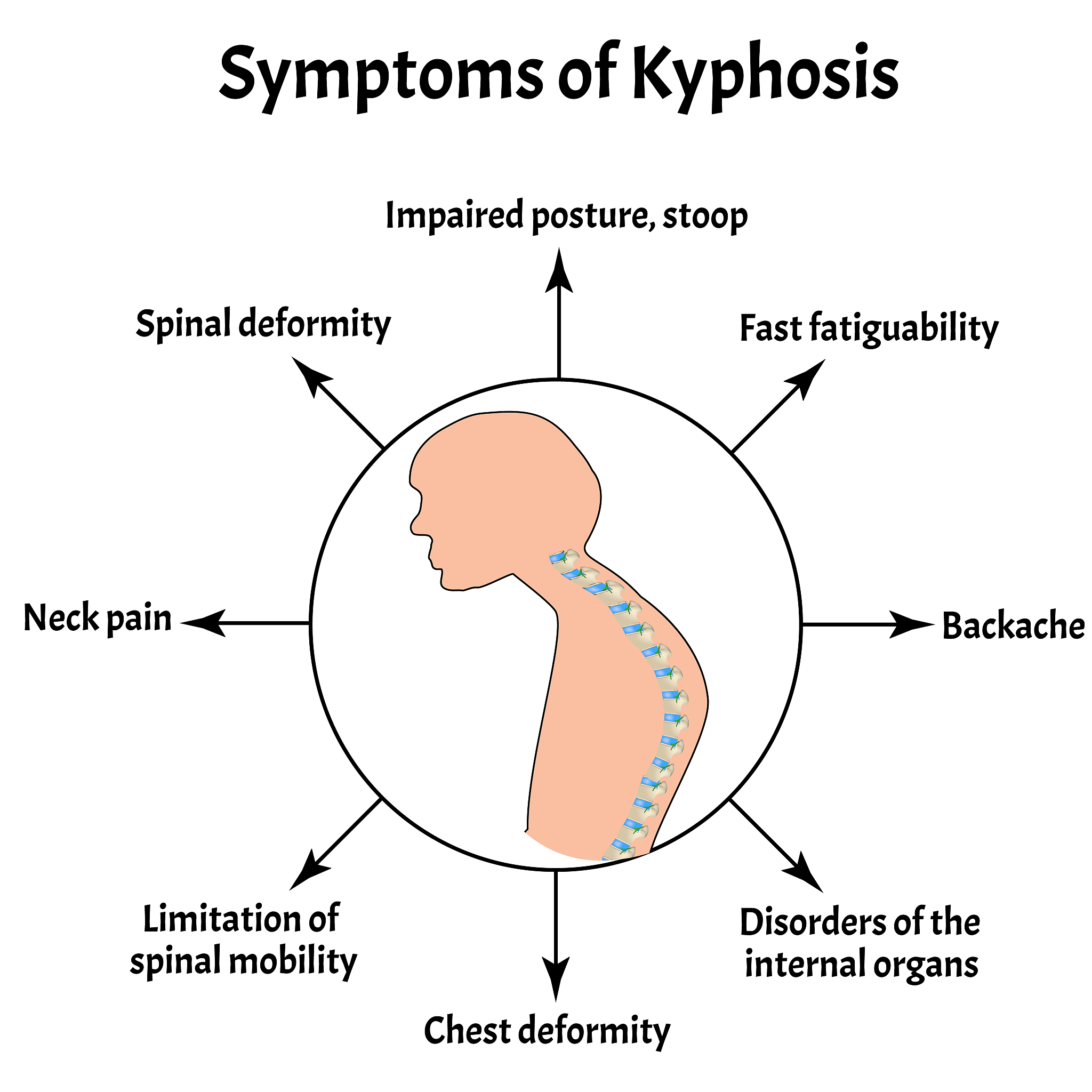 Stroke Symptoms: Sudden Onset of Dizziness, Weakness, and More - Seek Immediate Help