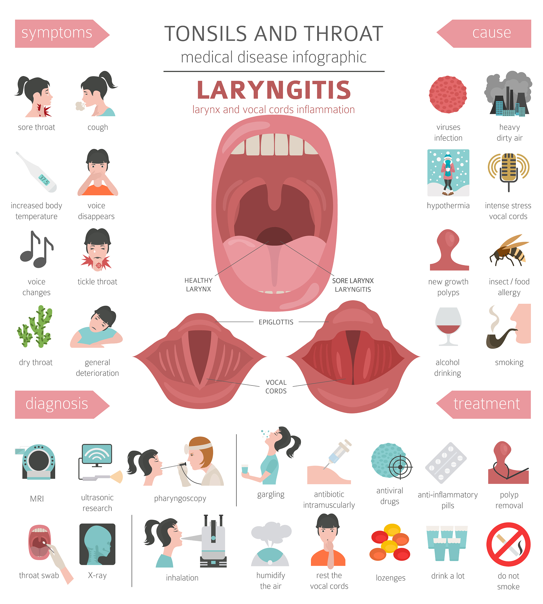 扁桃体电切术：治疗扁桃体肥大的有效方法