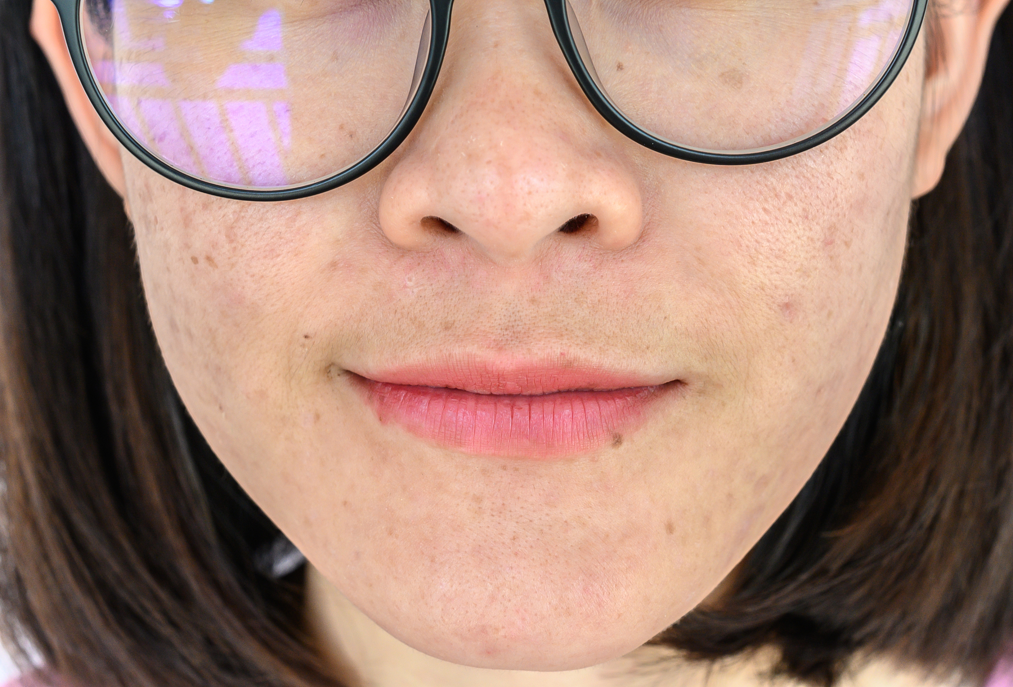 close up of woman face has variety problems on her skin (such as