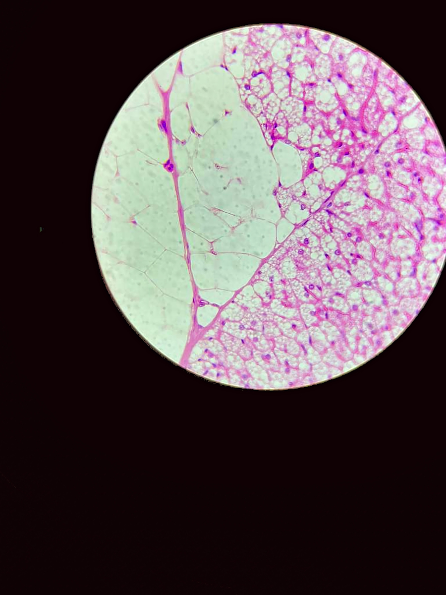 石蜡切片法固定后怎么操作