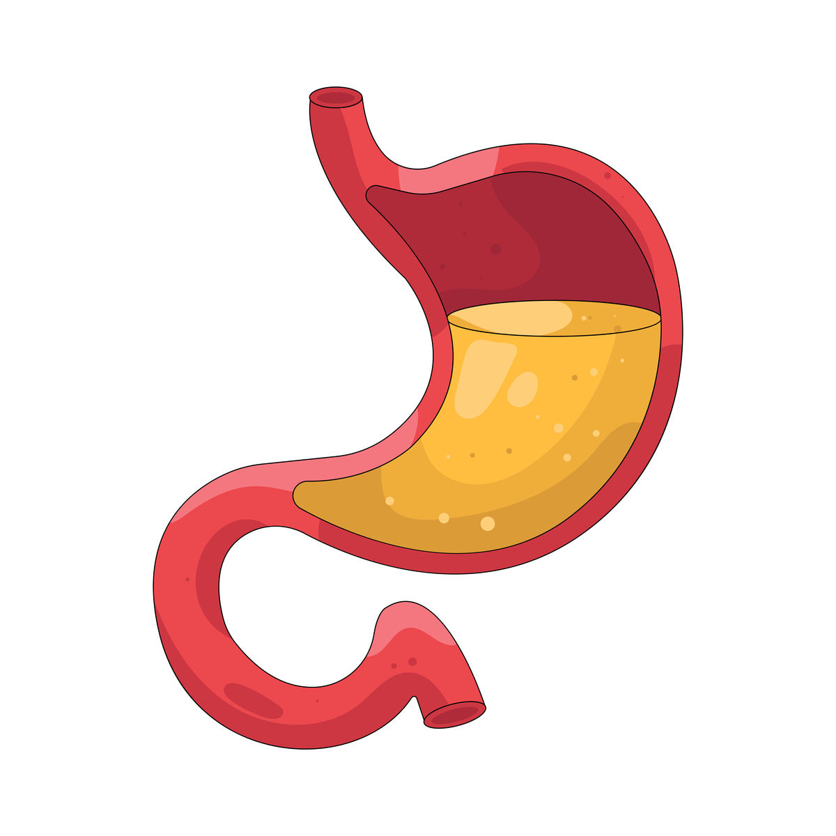 胃不好吃什么？300字解答，助你轻松养胃！