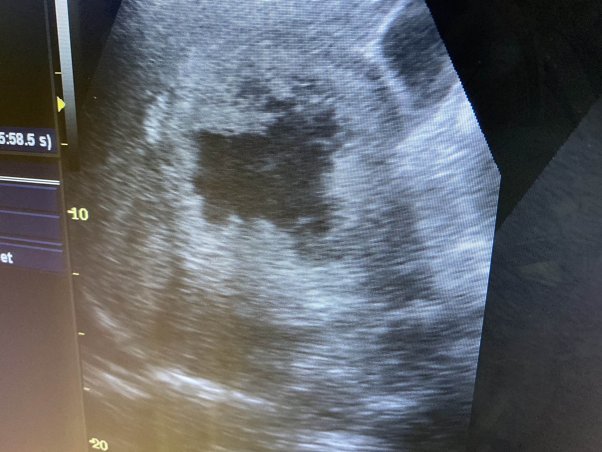 UNet边缘增强损失函数论文：提升图像分割精度