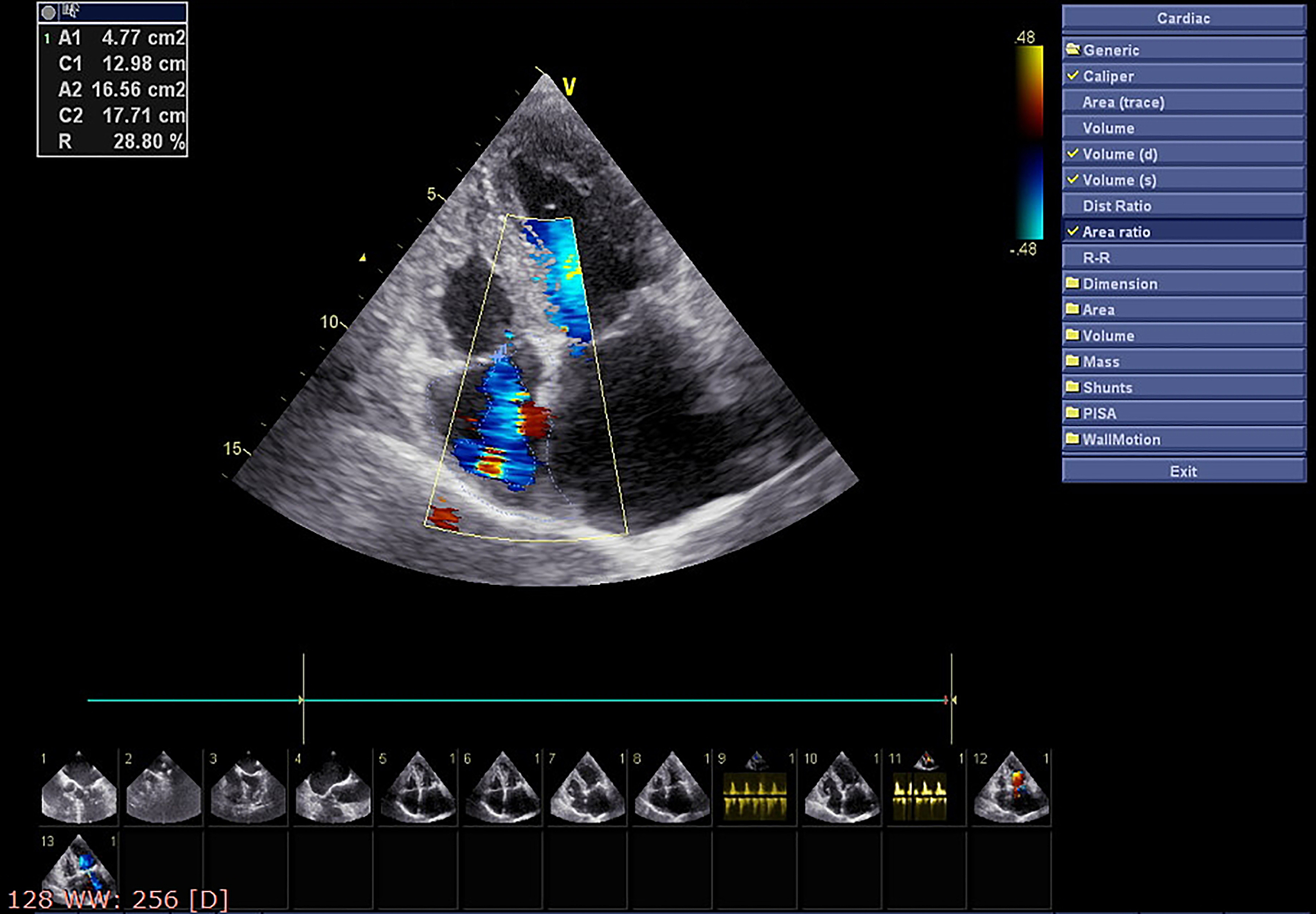 帮我写一个心脏瓣膜病超声诊断的课程导入