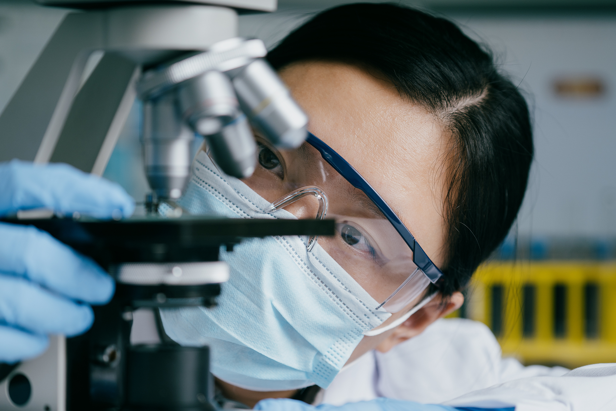 近视眼手术分享：我的真实经历与感受