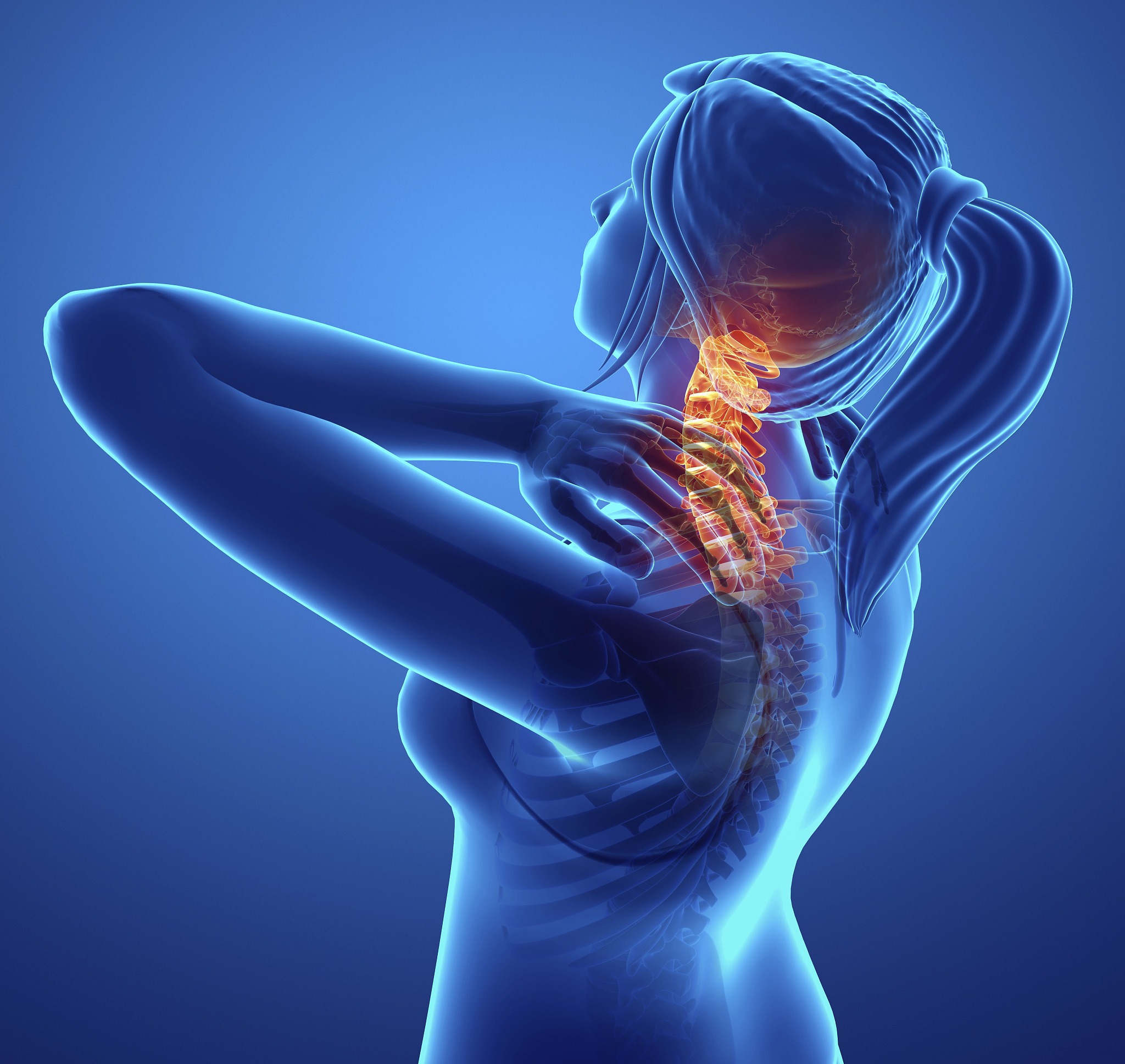 woman with neck pain, illustration