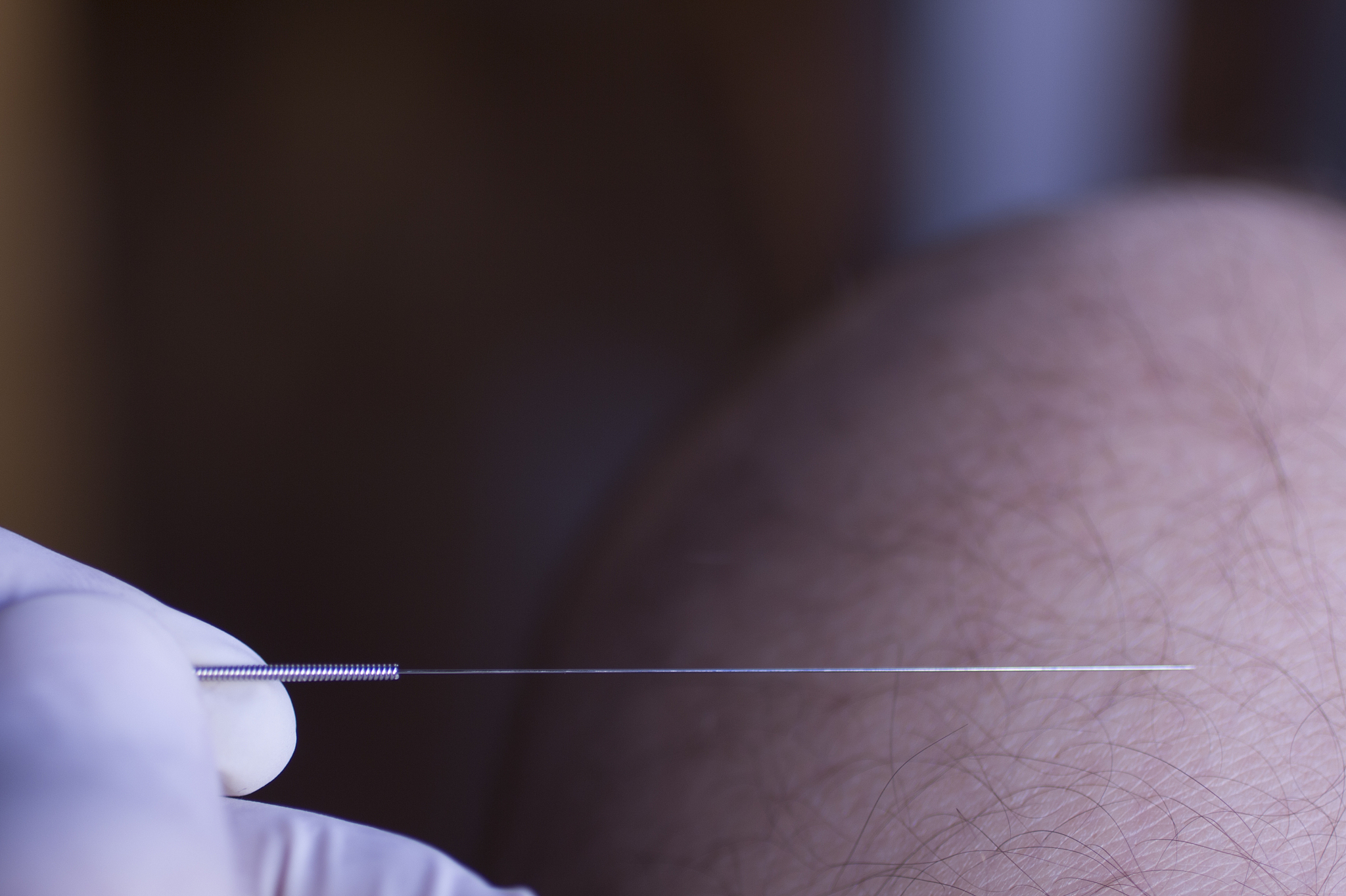 close-up of hand holding acupuncture needle