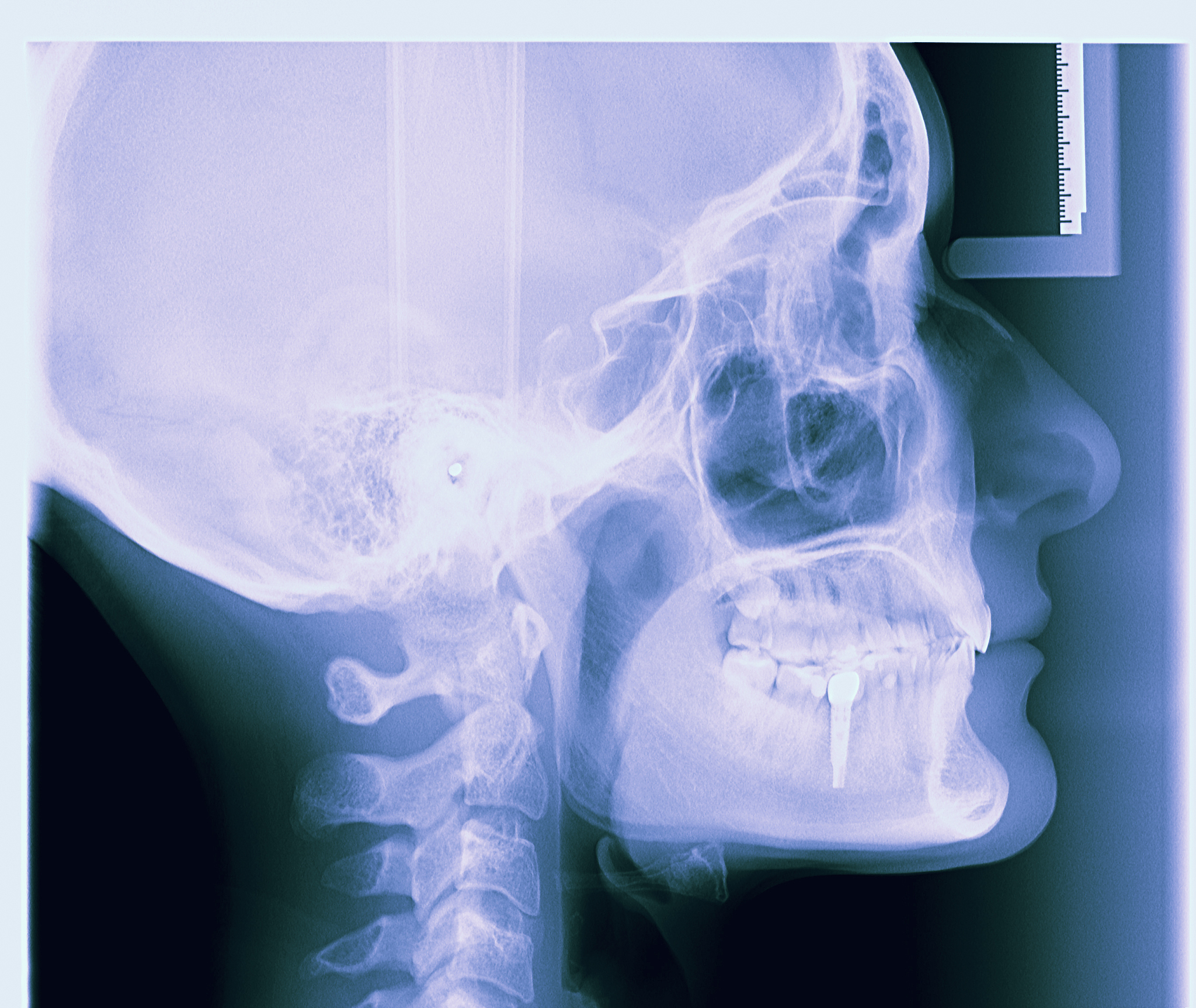 黄冈女生读什么卫校好？2022年热门卫校推荐