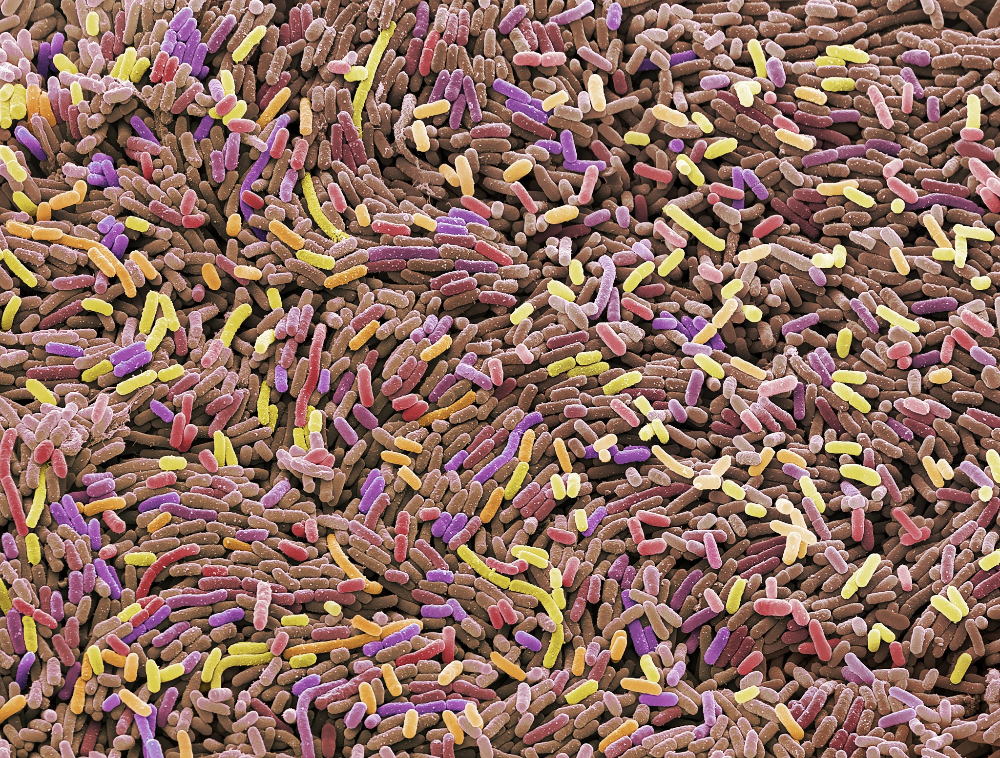 1g大肠杆菌细胞通常含有多少mg蛋白