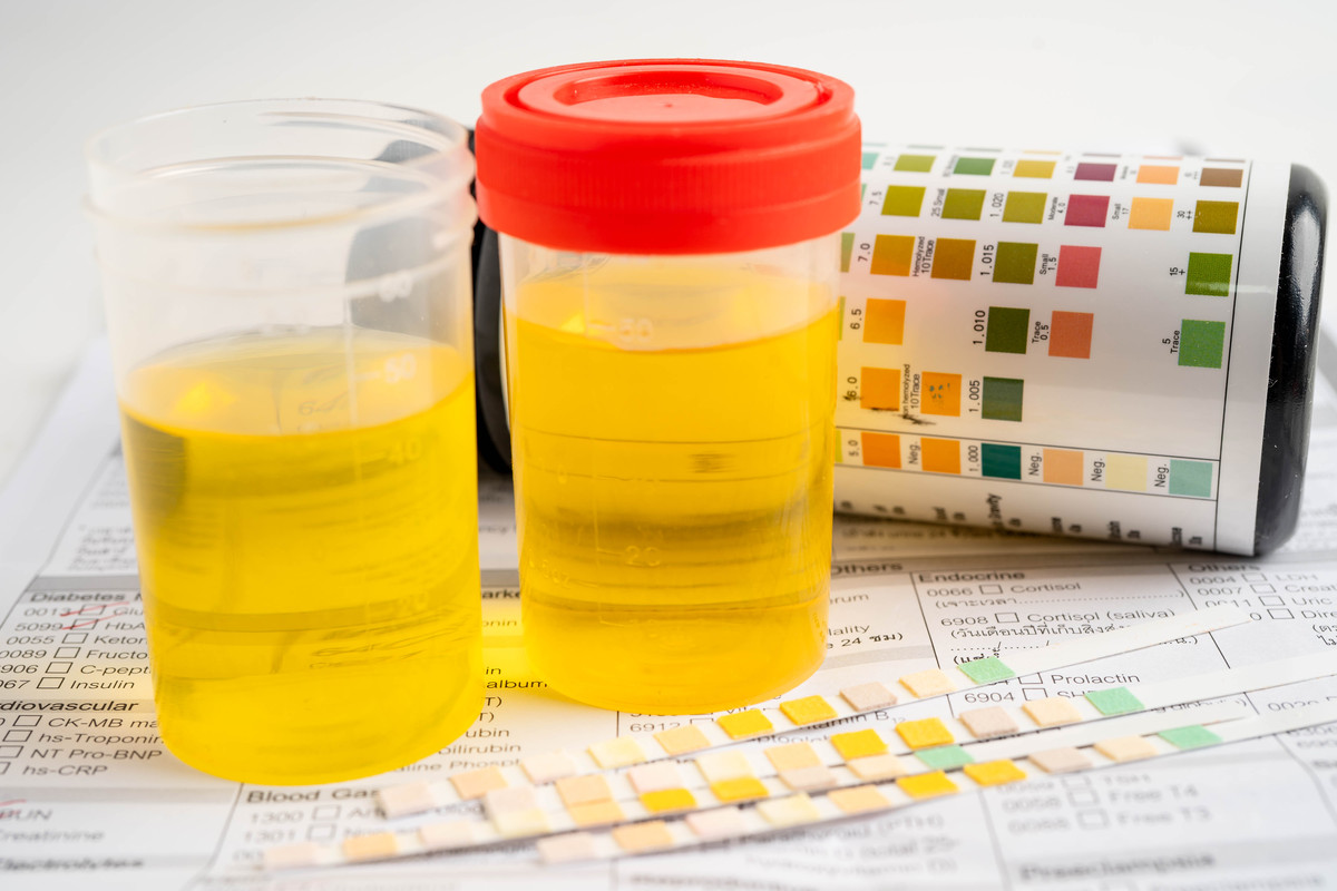 异硫氰酸酯颜色反应