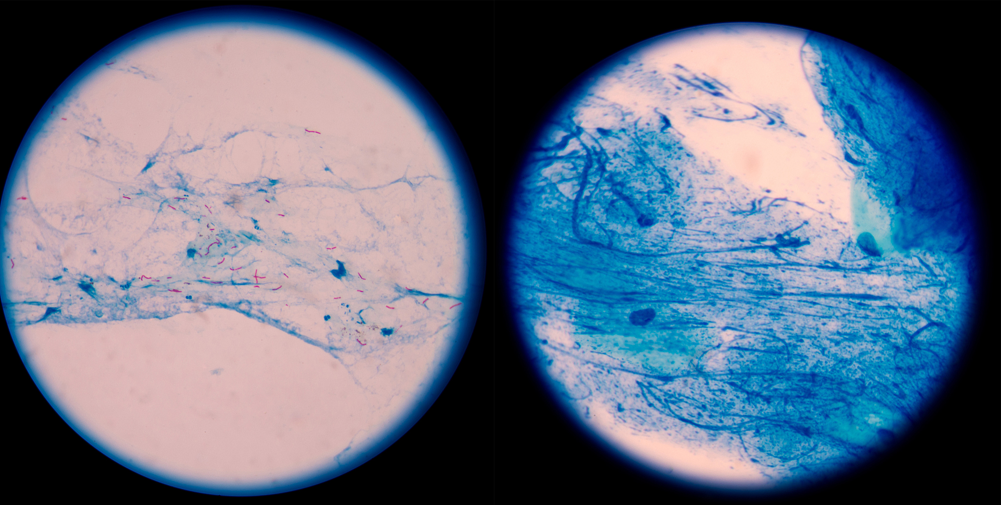 从材料和方法、 结果与分析、讨论和结论四个方面为论文生猪传染性肠胃炎的综合防治措施研究写一篇提纲。