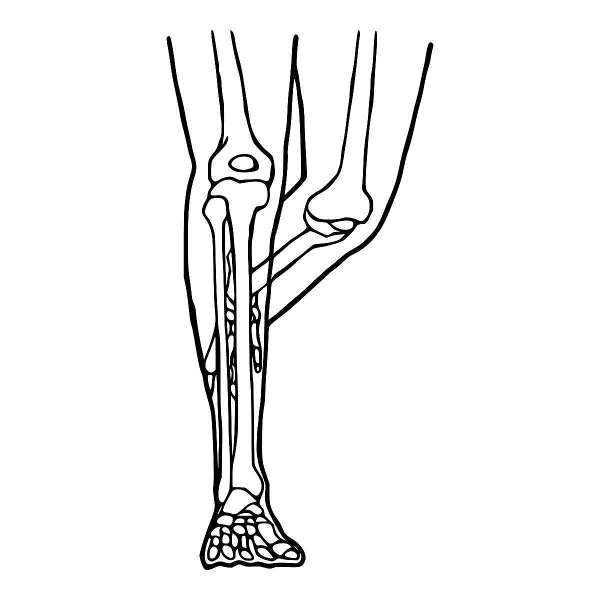 带线锚钉Broström术修复距腓前韧带损伤并加强外侧结构的疗效