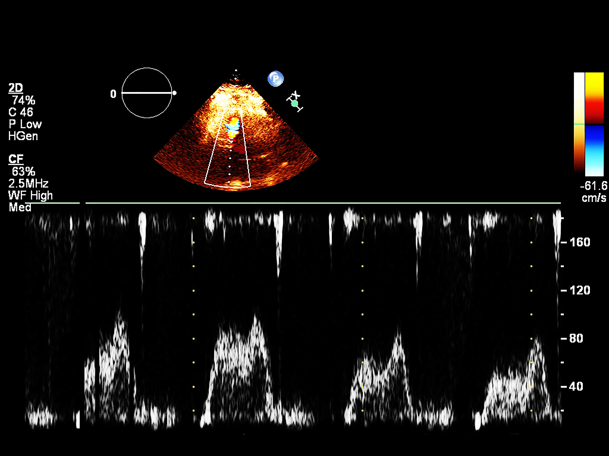 对于雷达信号穿过大气层的场景计算区域可以是一个三维空间边界条件可以考虑大气层的折射率和反射率以及地面的反射率和散射率等