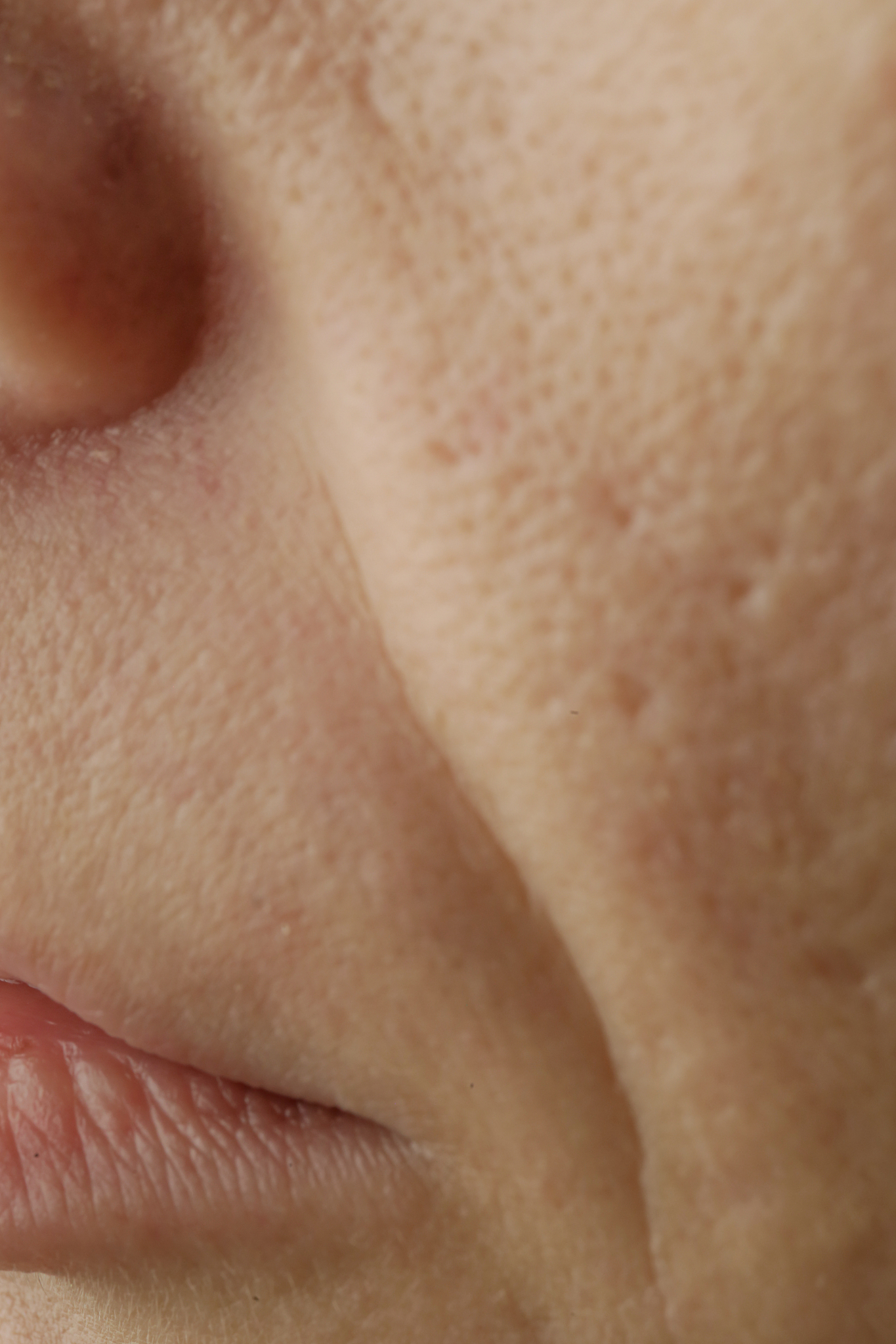 close up of female face problematic sensitive skin with large po