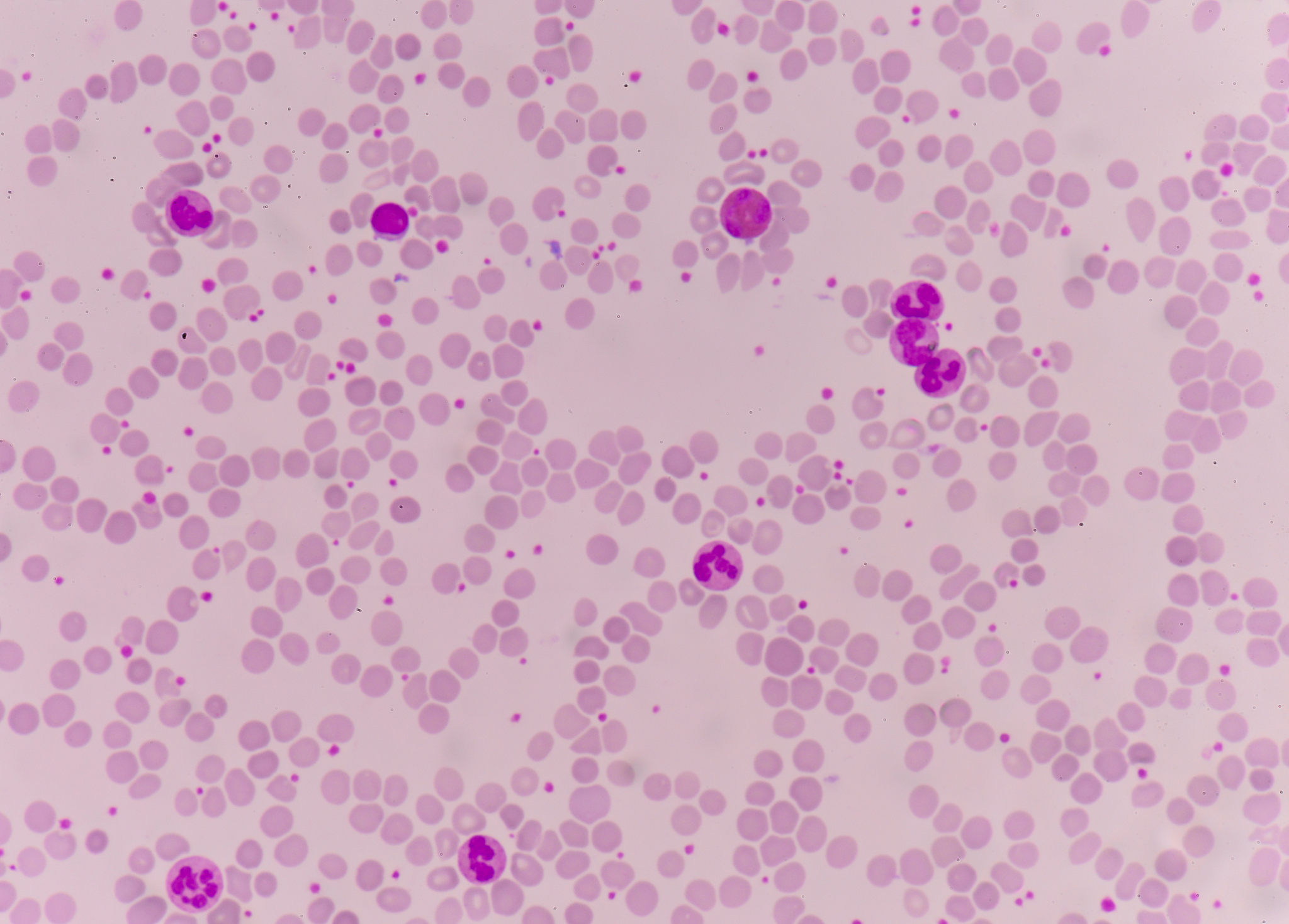 白细胞分类计数的临床意义和检测方法