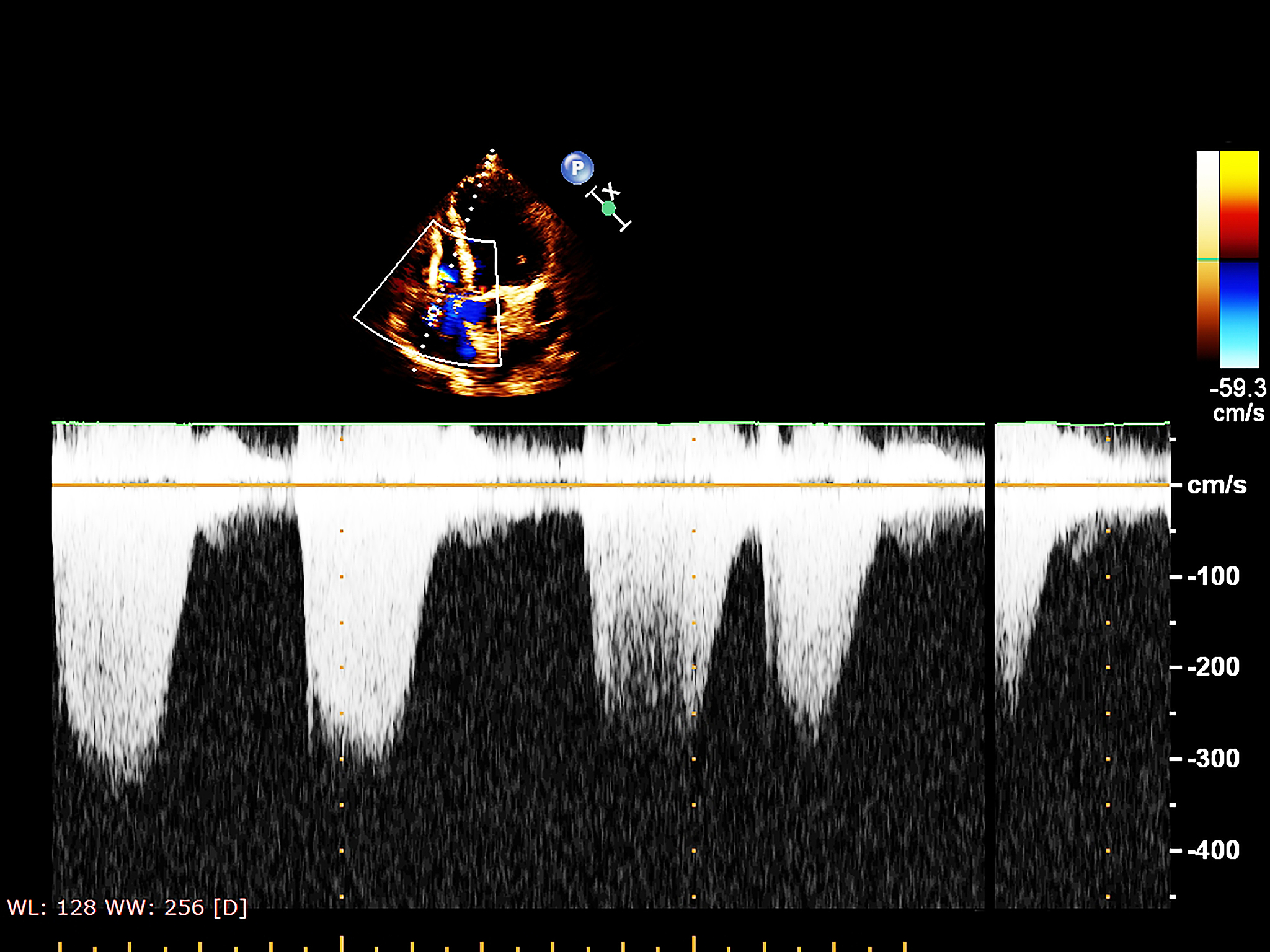 HSV 中心距法公式：计算图像颜色相似度