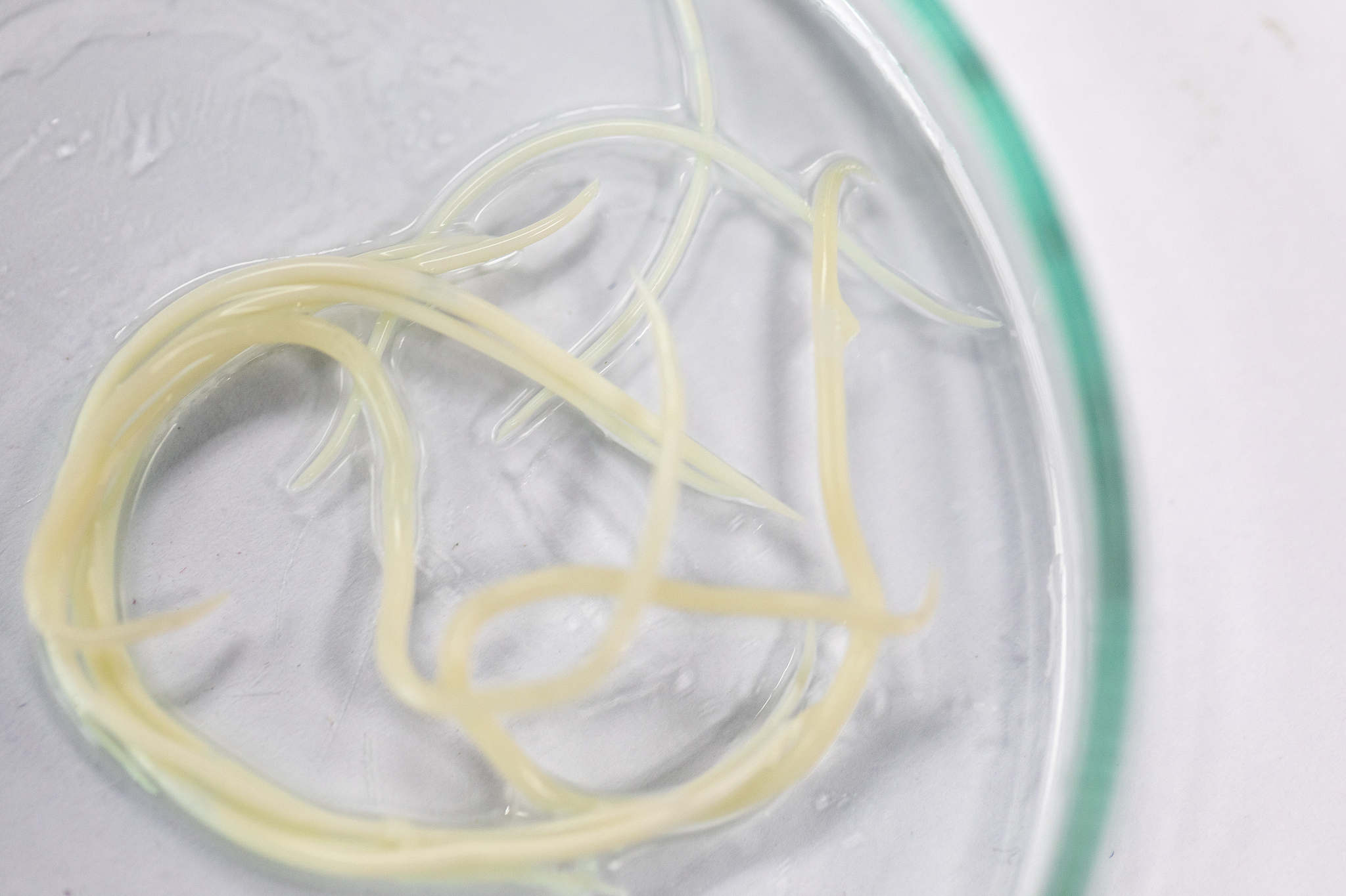 黄鳝寄生虫能煮死吗？如何安全食用黄鳝？