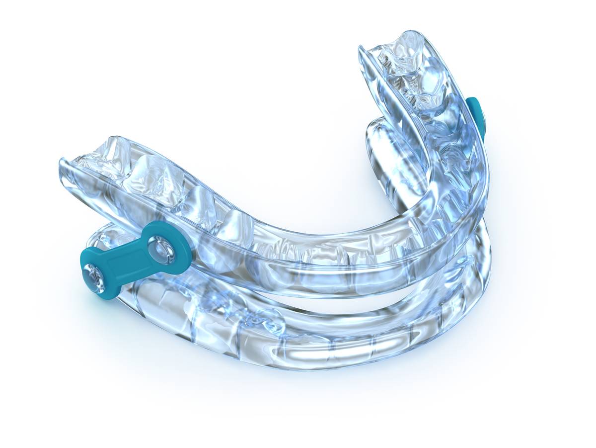 orthodontic elastics在口腔专业英语中是什么意思