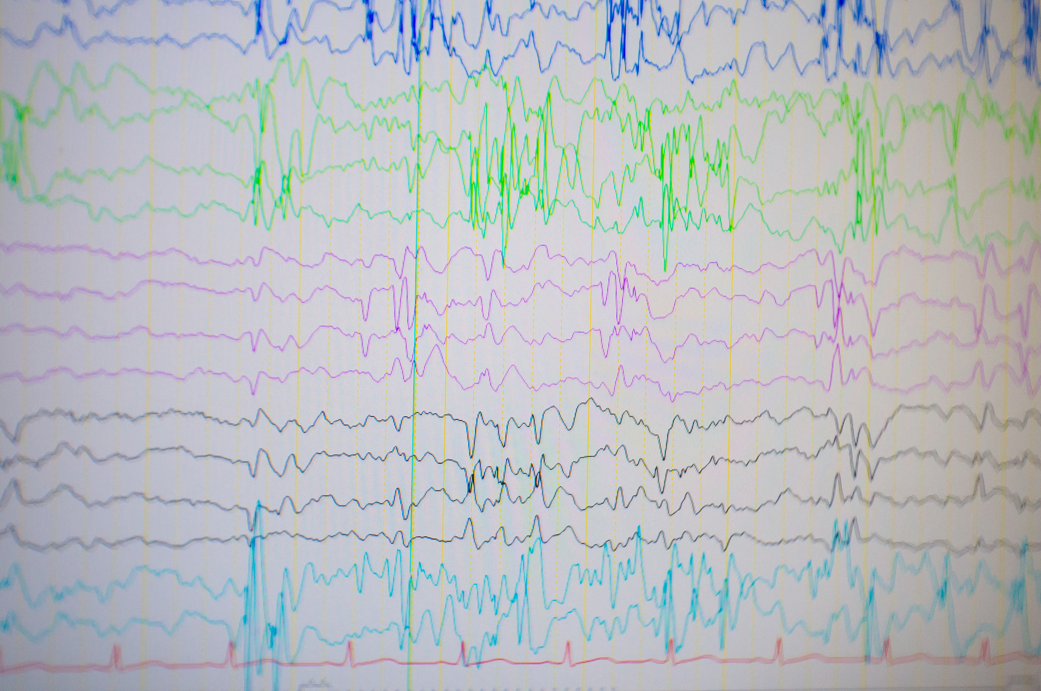 大脑在不与外界环境接触不想象身体没问题的的情况下会受到刺激吗？