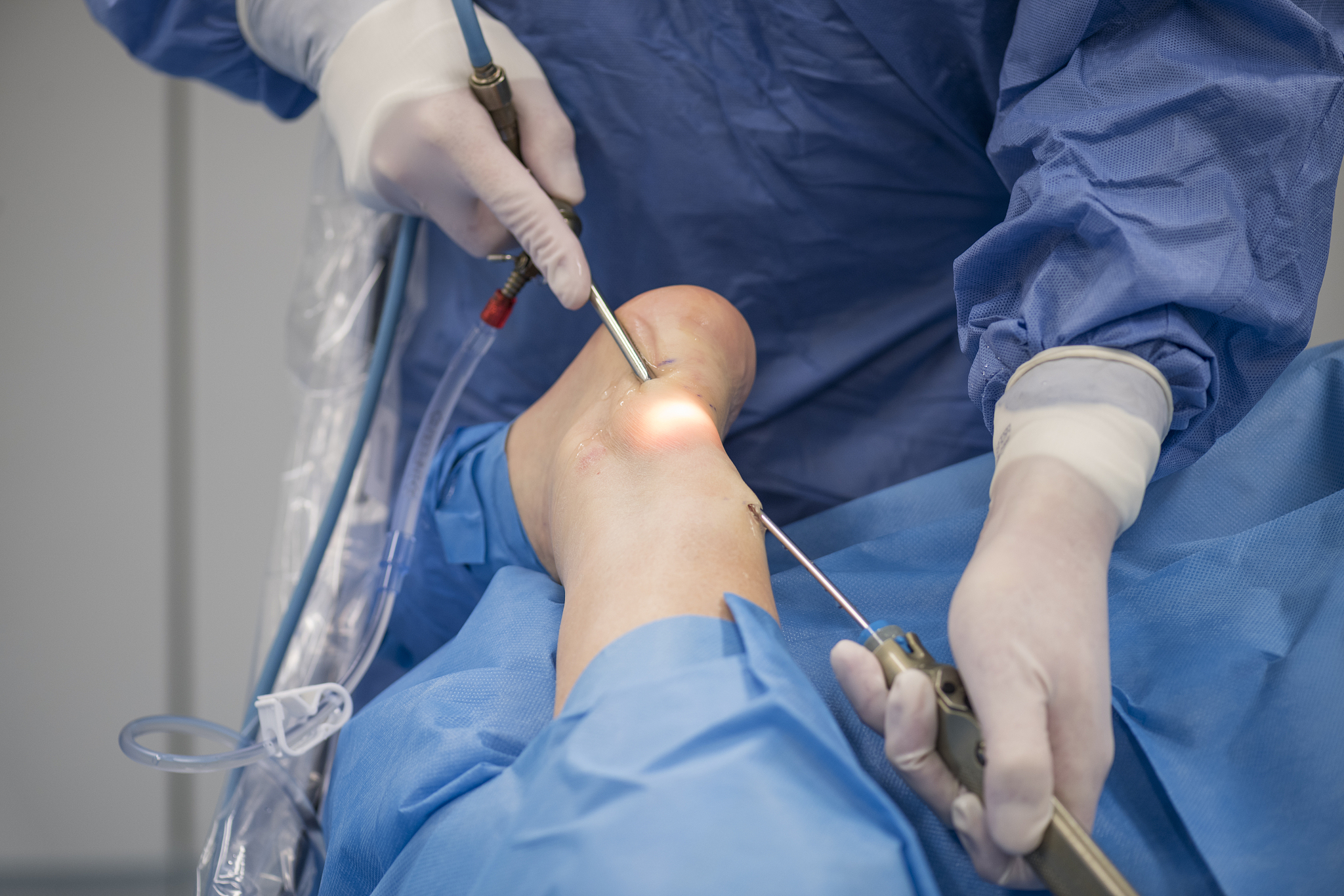 orthopedic surgeon performs endoscopic surgery on achilles tendo