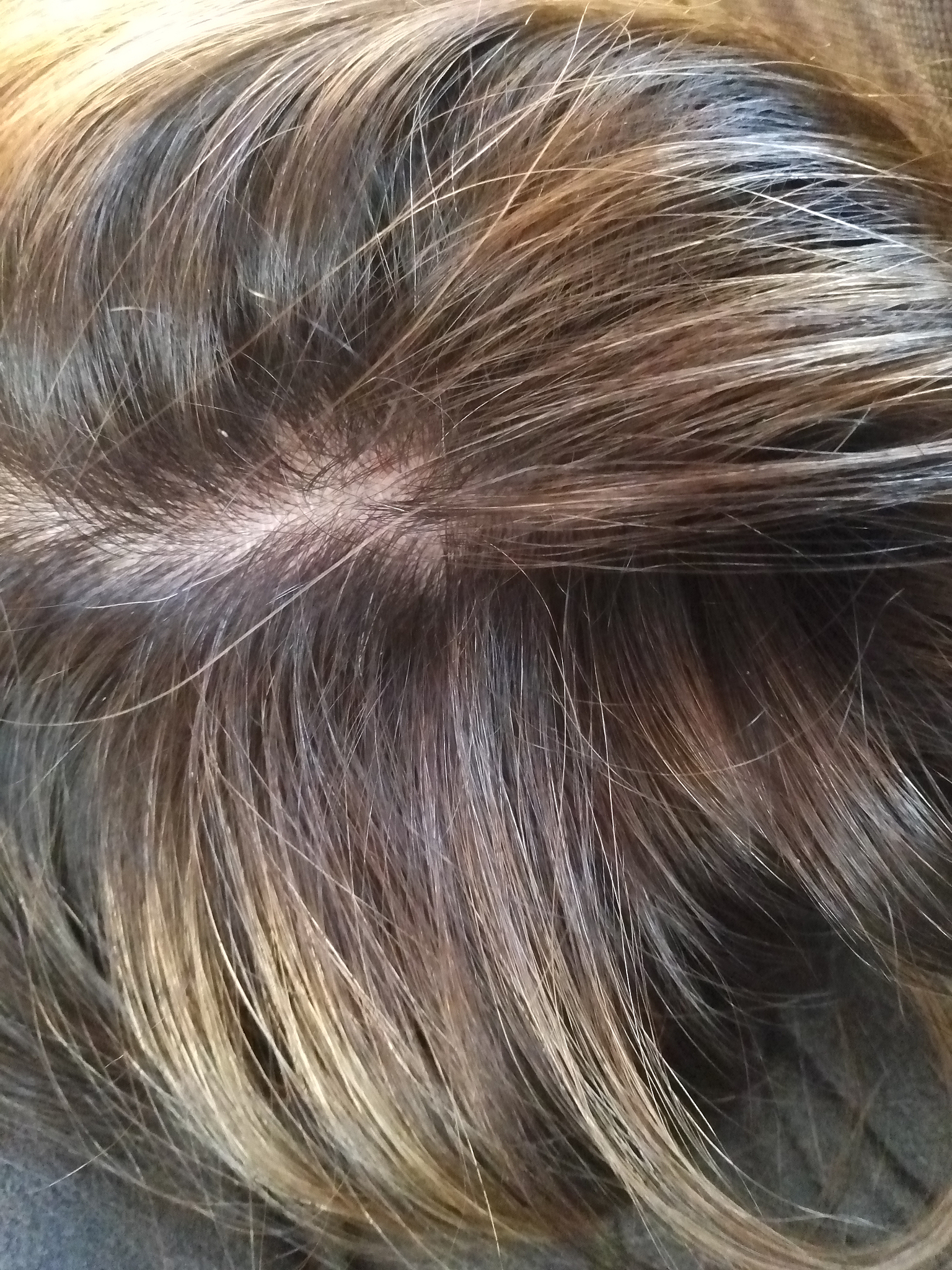 盐洗头发有什么好处和坏处