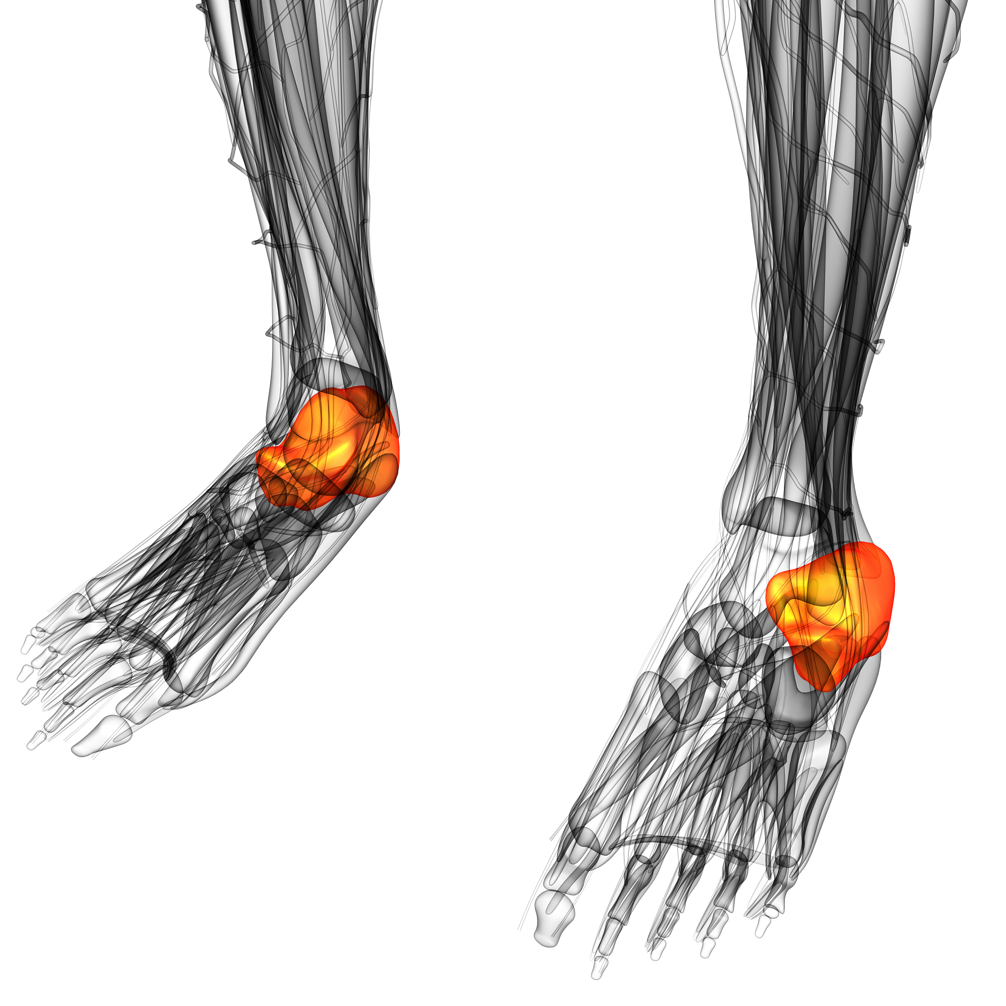 踝关节外侧韧带复合体微创修复重建：关节镜手术的优势