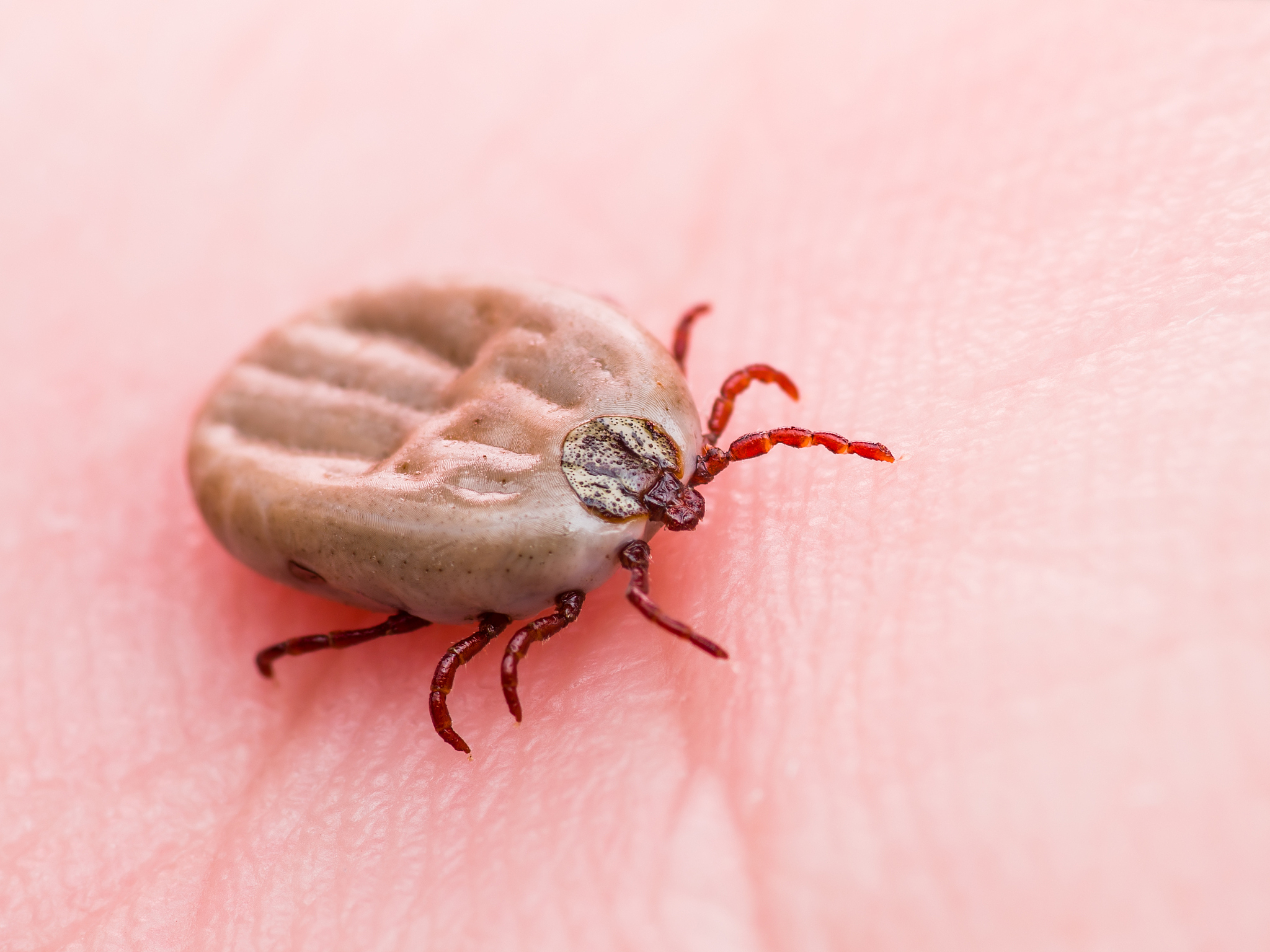 抗LGI1脑炎：临床特征、诊断与治疗