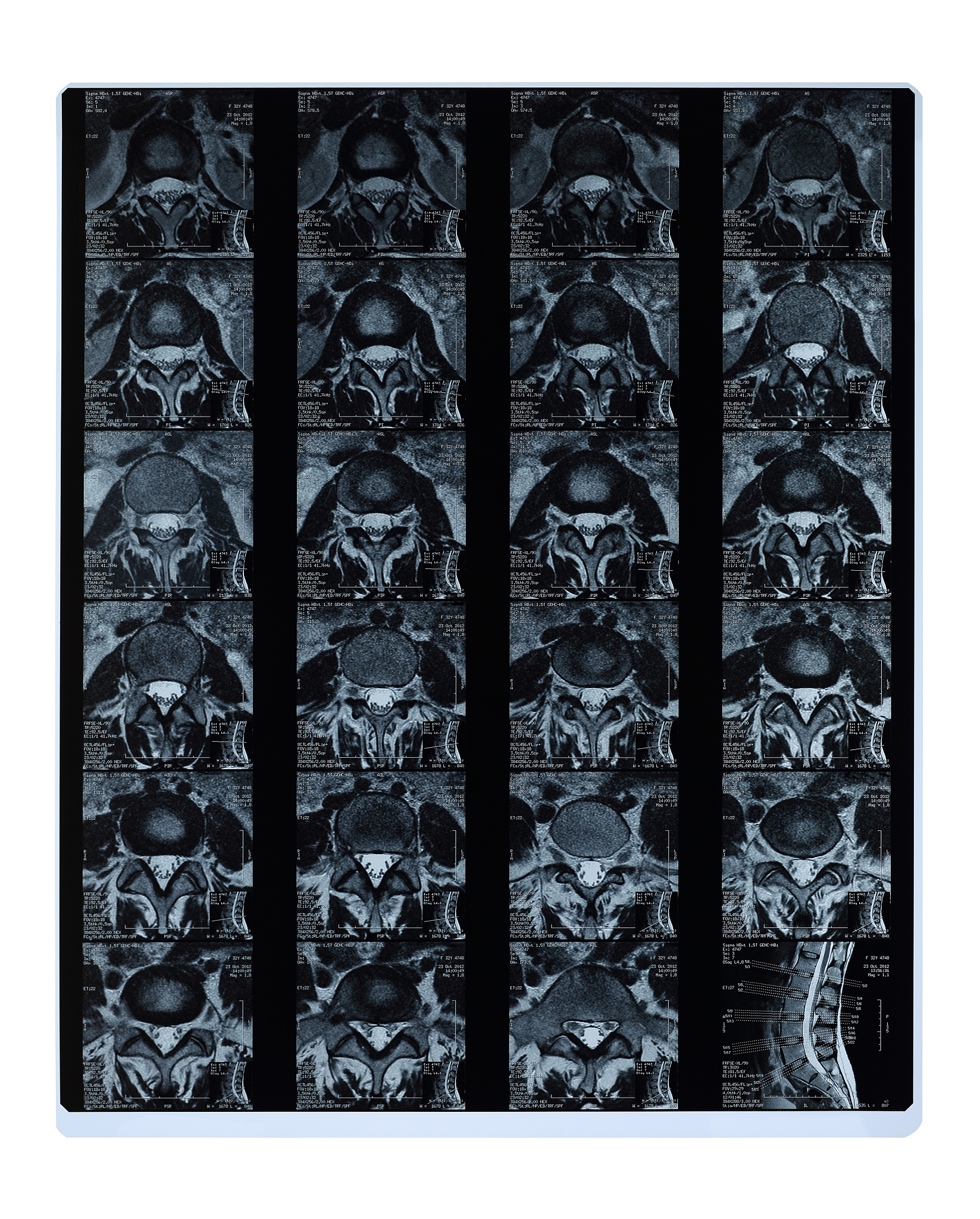 CT影像存储格式都是三维的吗？