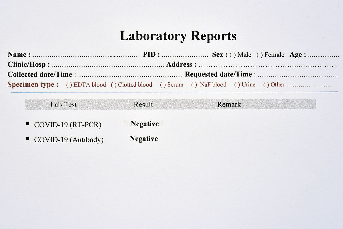 如何进行产品的品质控制和质量改进