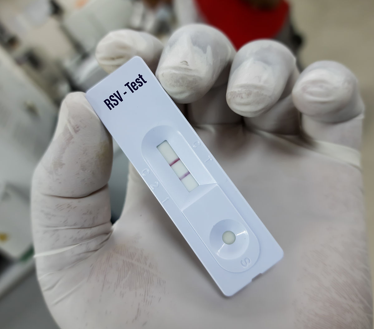 改写PM25可引起肺组织炎症姚琳13等在研究桔梗总皂苷对PM25致大鼠肺损伤的影响时发现桔梗总皂苷可减轻此类肺组织炎症的发生可能的作用机制为桔梗总皂苷可平衡调节肺组织炎性细胞因子产生作用从而对肺组织产生保护及修复作用。呼吸道合胞病毒RSV可引起儿童下呼吸道感染研究表明桔梗总皂苷可抑制RSV活性。来降低查重率