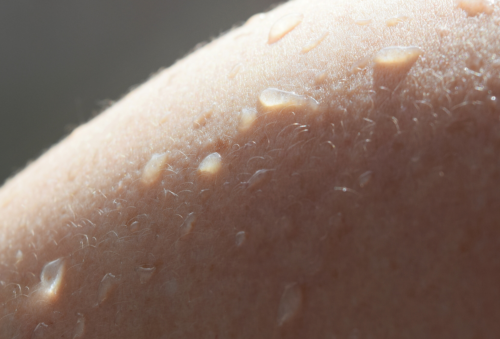 drops on the skin