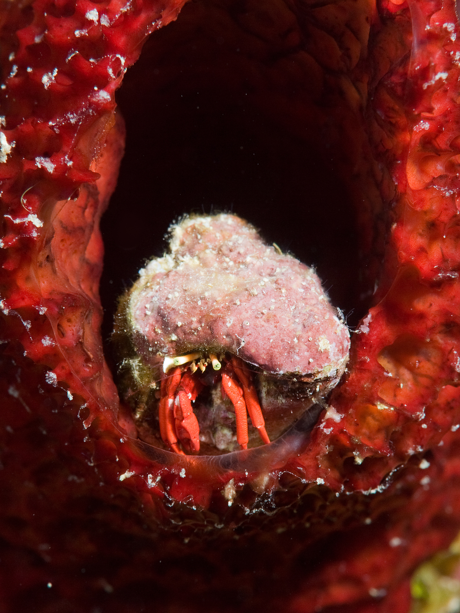 腹膜后脂肪肉瘤研究进展的综述