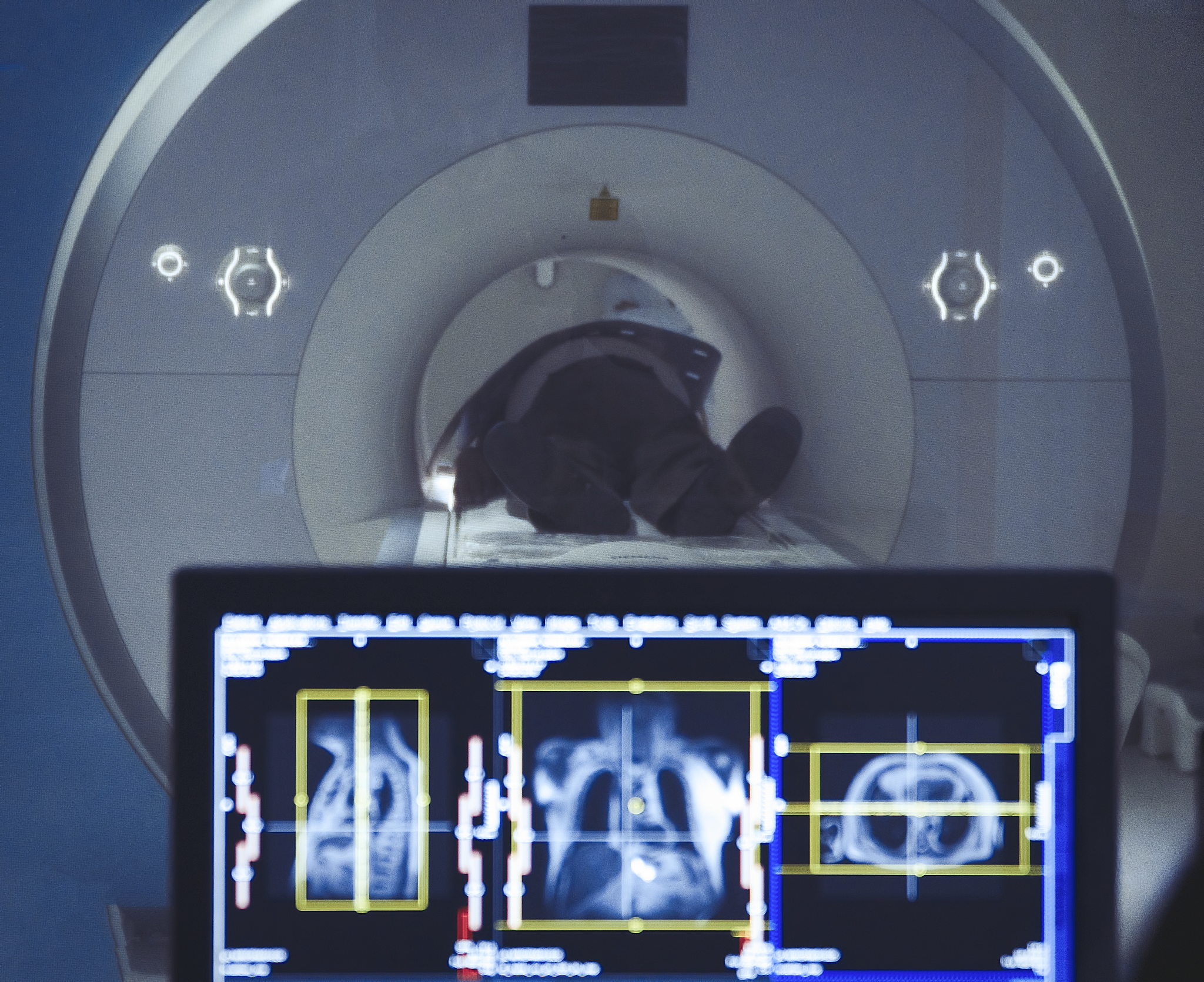 全视野数字切片扫描：应用领域及优势 - 全面解析