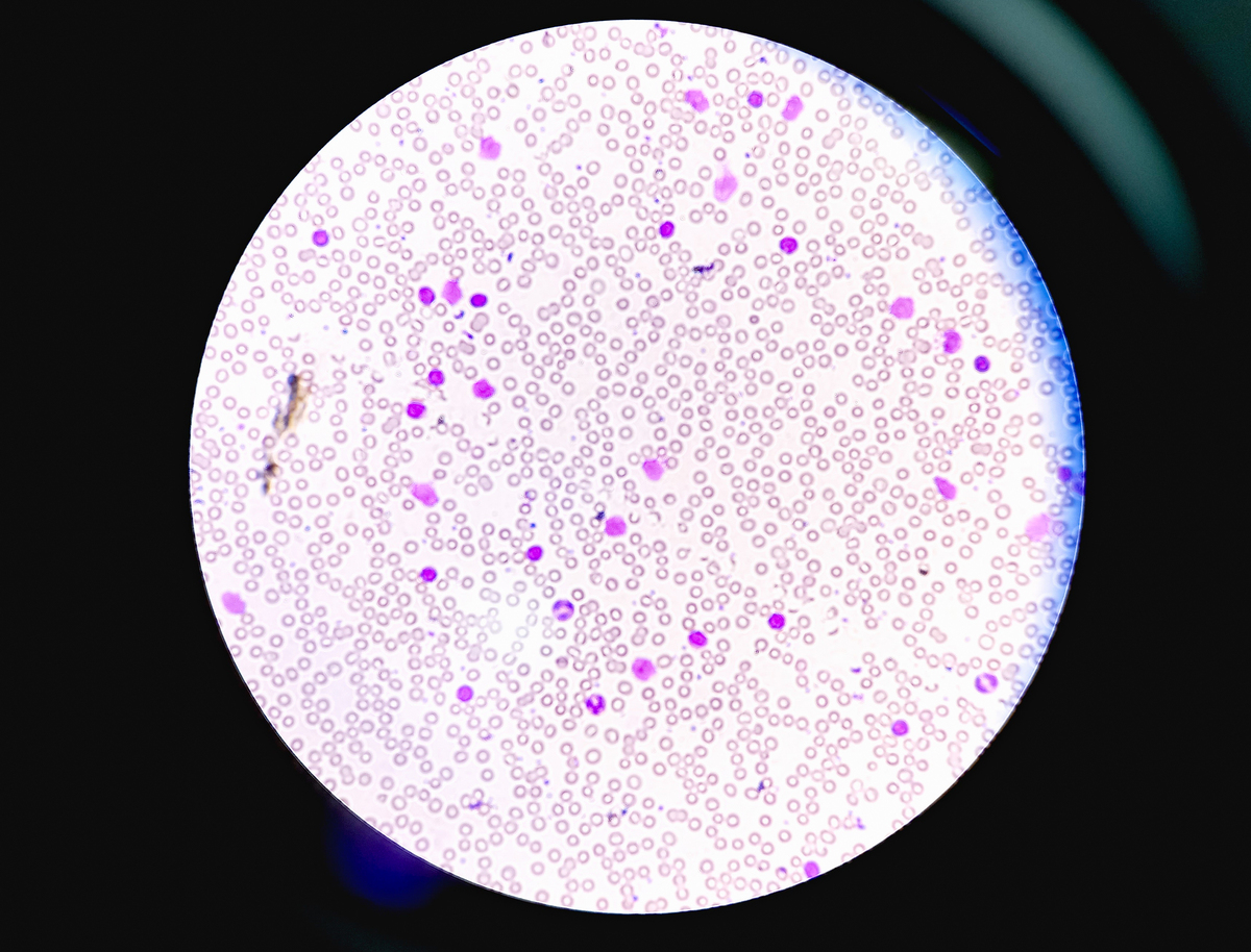 The Enduring Romance of Senescent Cells: A Lifelong Commitment